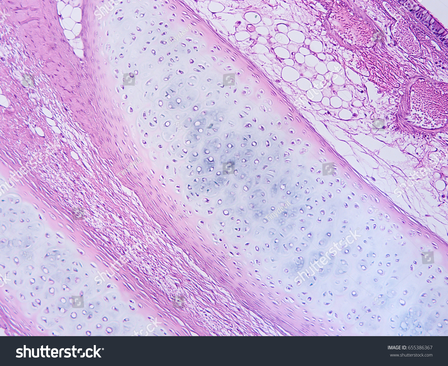 Trachea Cartilage Histology