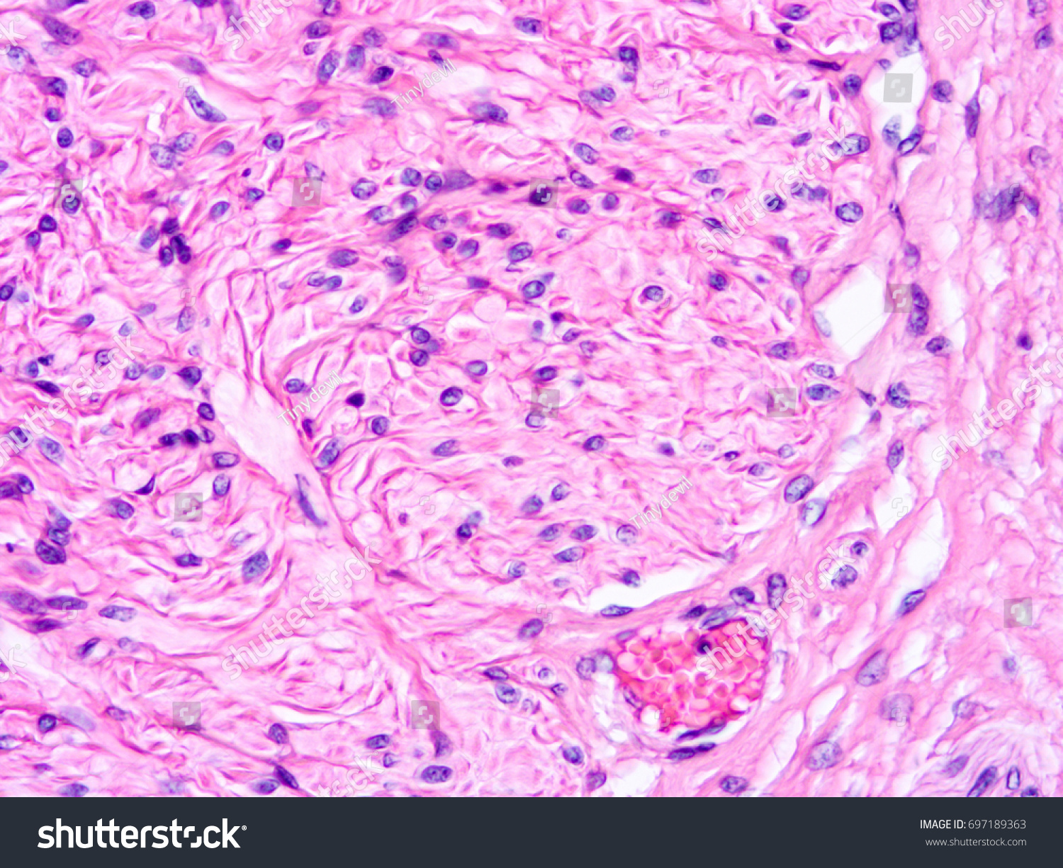 Histology Human Vasdeferens Tissue Show Epithelium Stock Photo ...