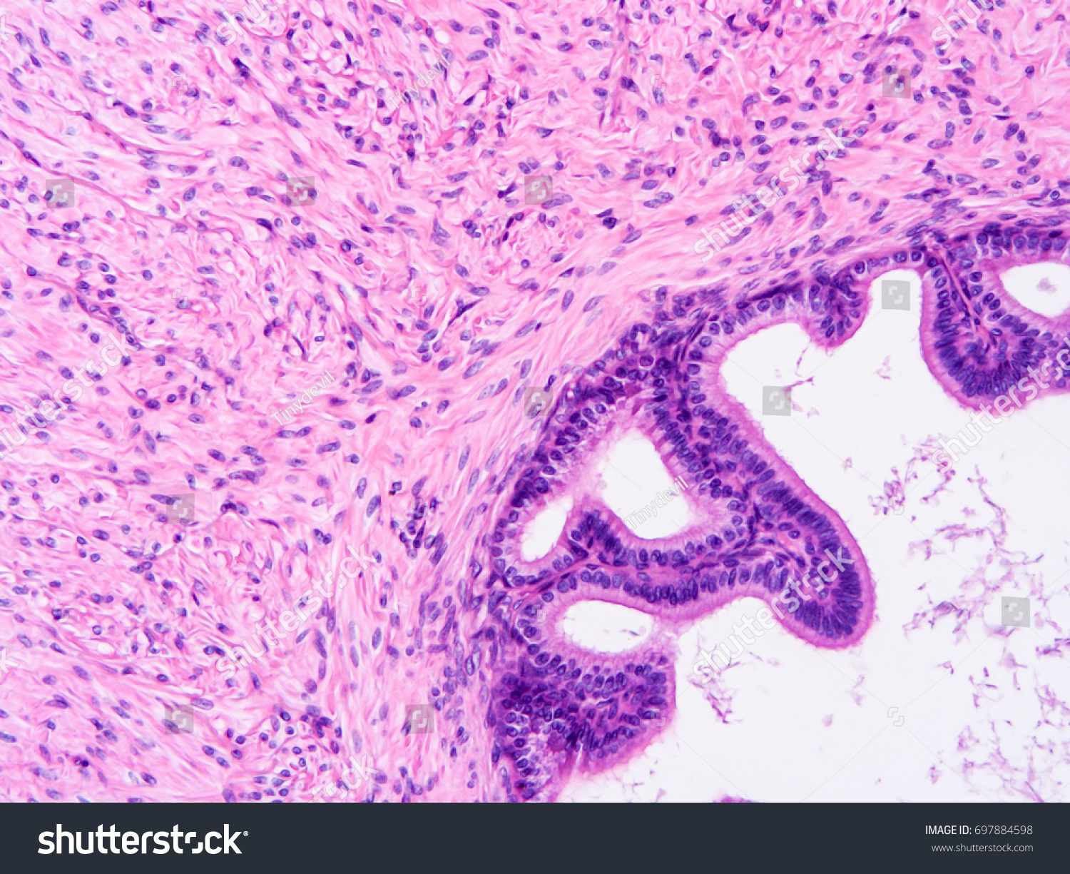 Histology Human Vasdeferens Tissue Show Epithelium Stock Photo ...