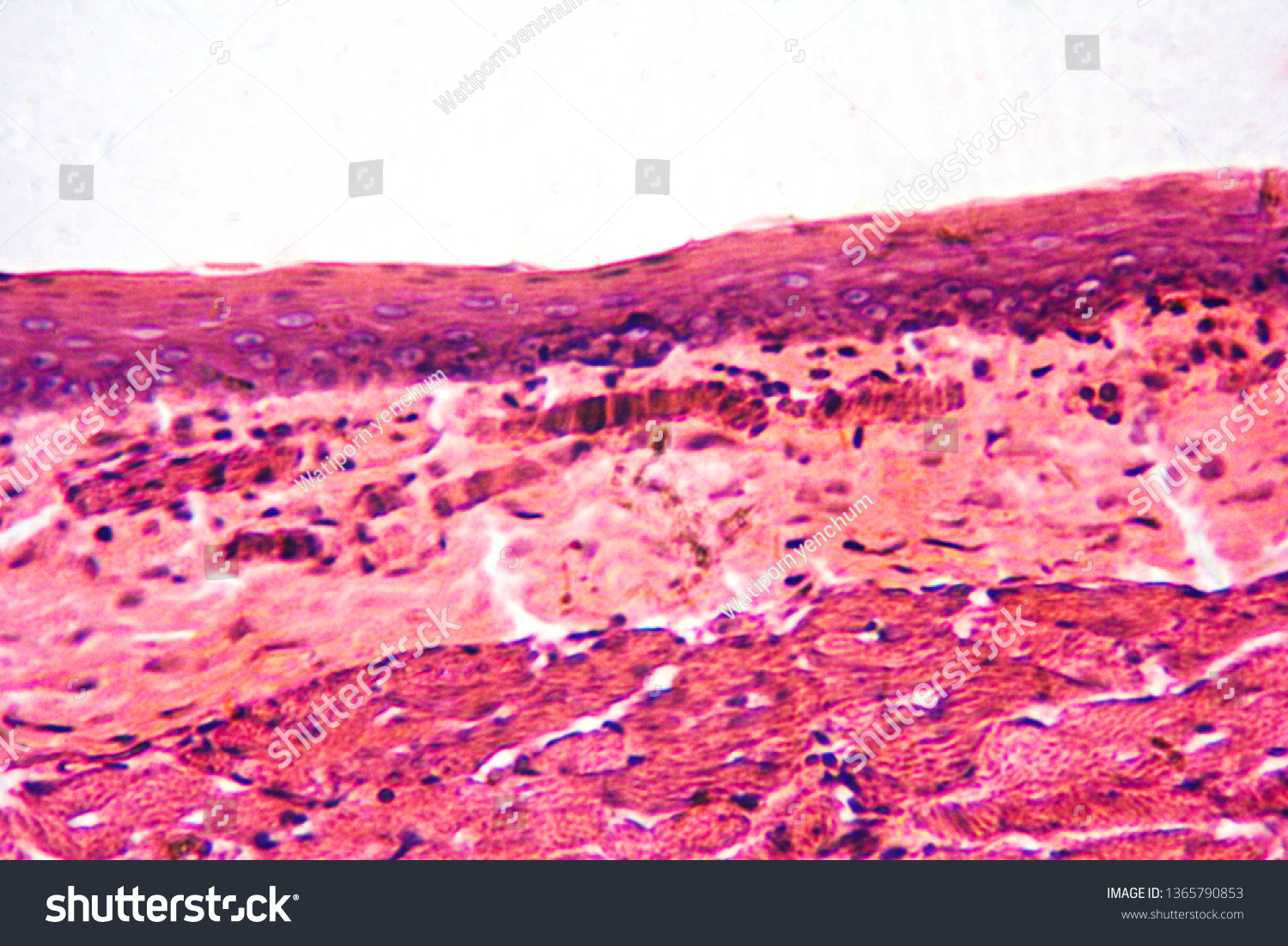 Histology Long Section Oesophagus Under Light Stock Photo (Edit Now ...