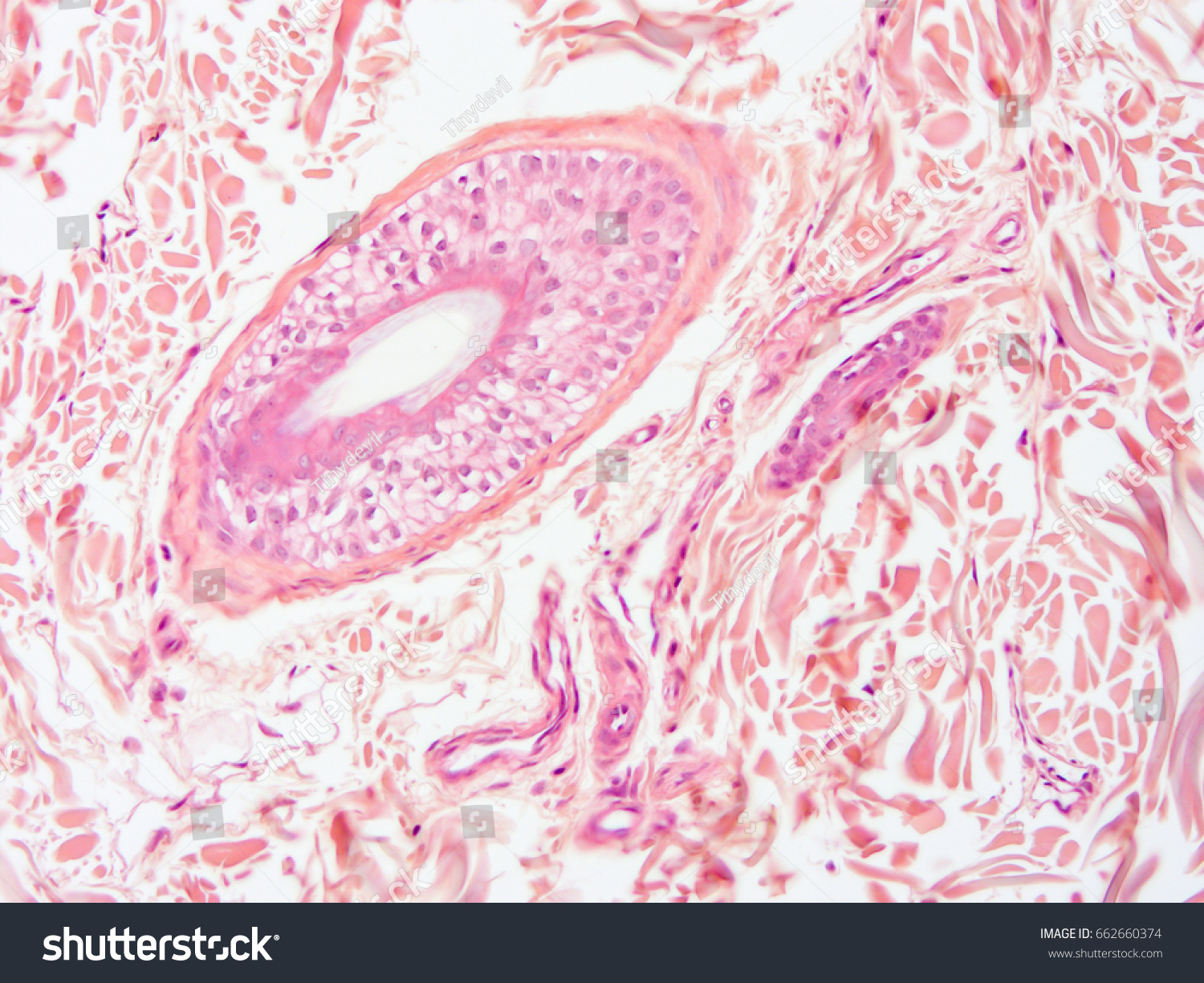 Histology Scalp Hair Follicle Human Tissue Stock Photo 662660374 ...