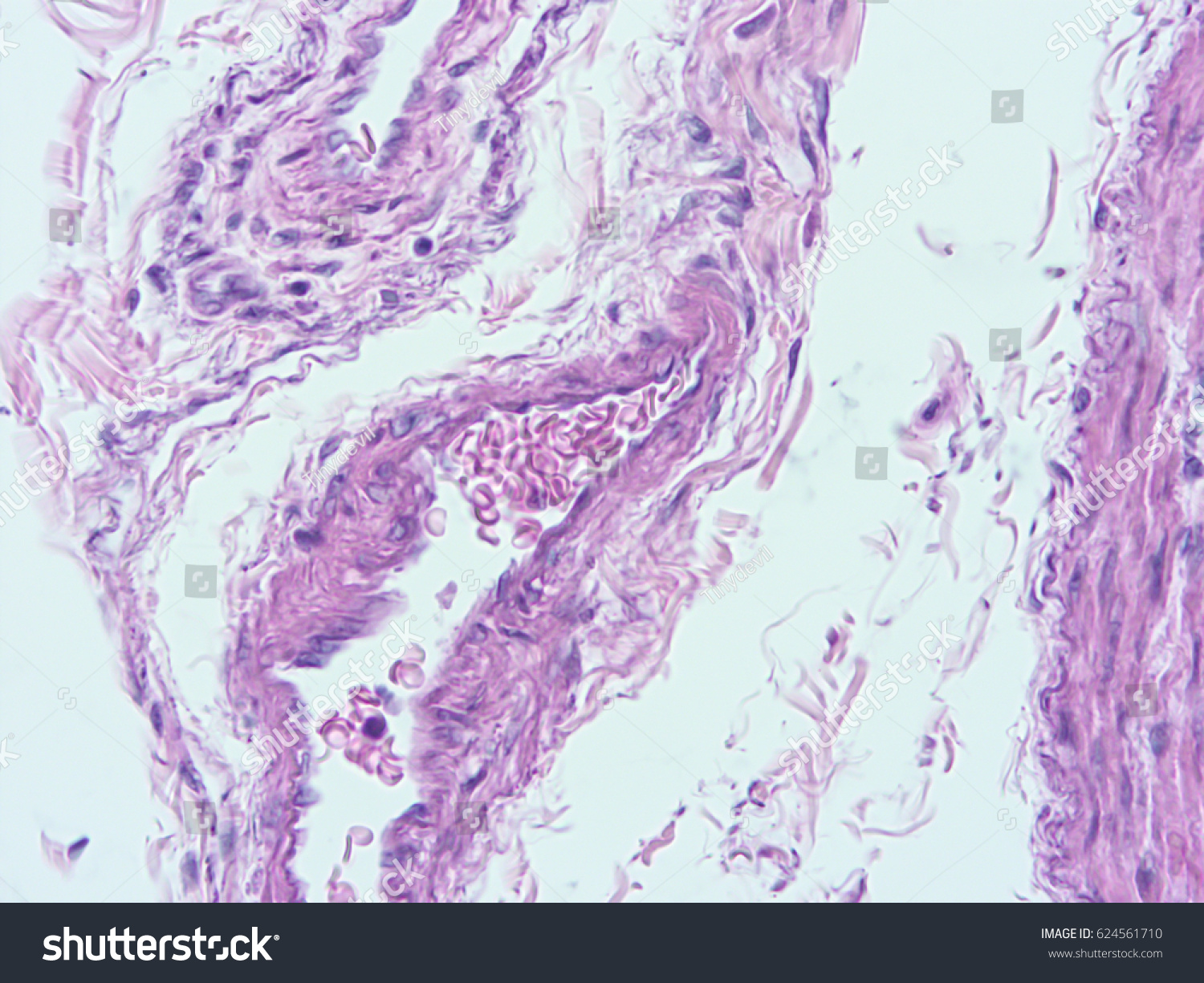 Histology Smooth Muscle Uterine Wall Show Stock Photo 624561710 ...