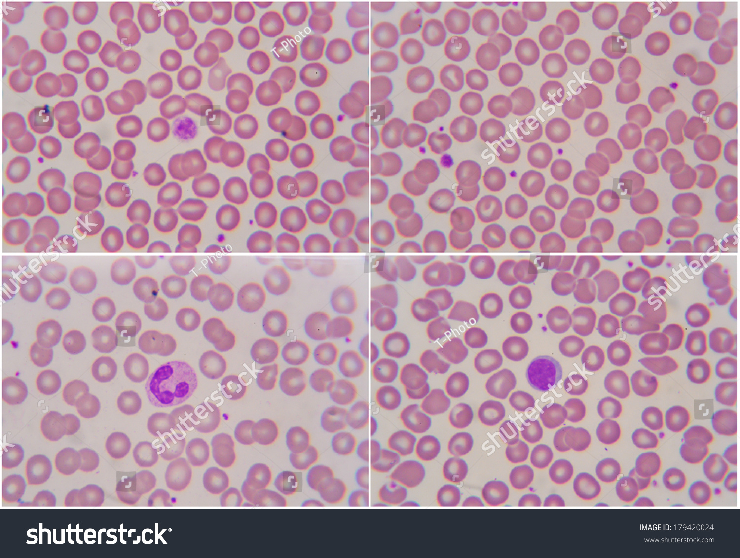 Human Blood Cell Under Microscope Stock Photo 179420024 : Shutterstock