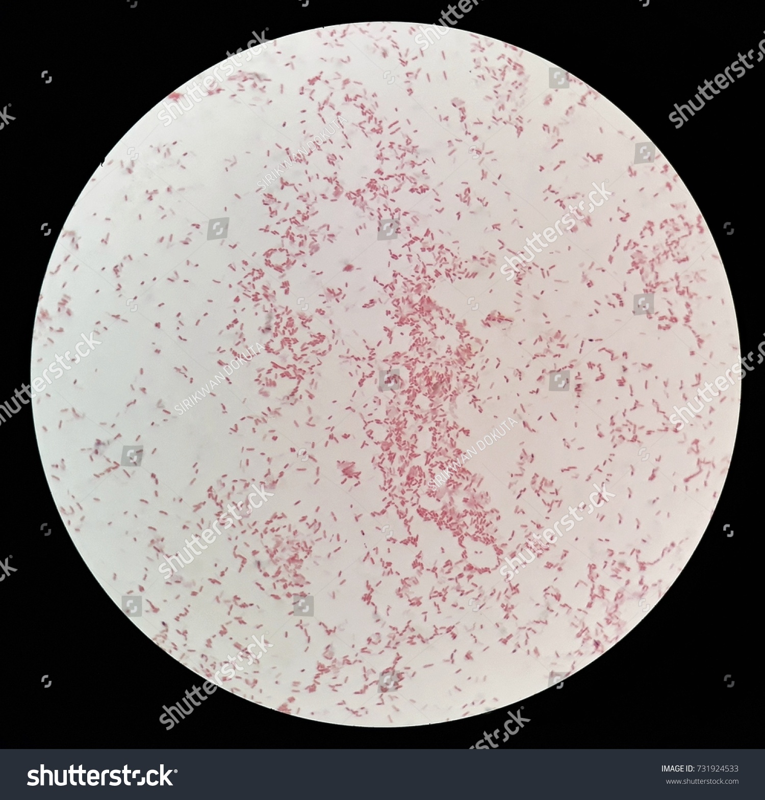 Human Blood Cultured Grams Stained Gram Stock Photo 731924533 ...