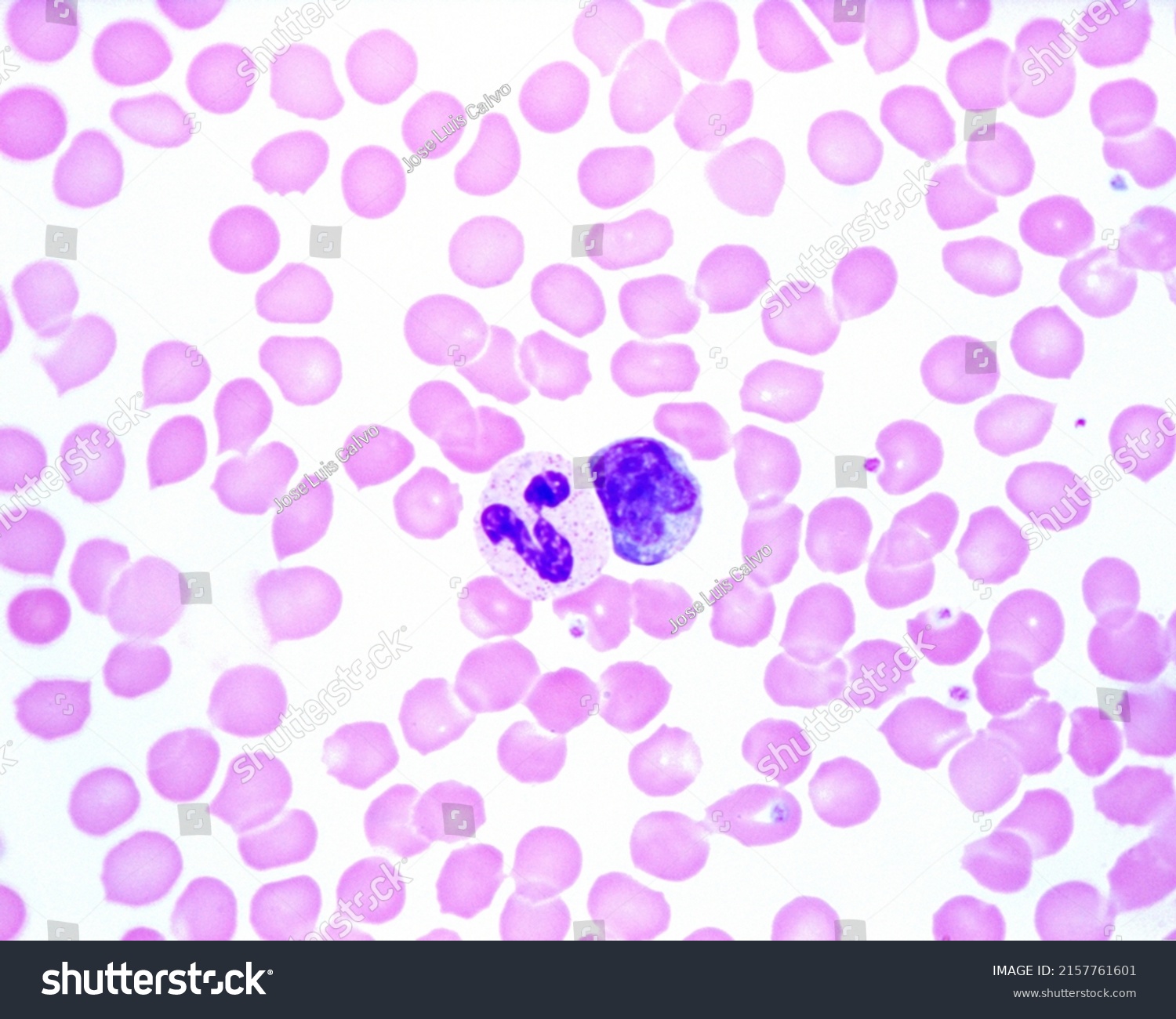 Human Blood Smear Showing Neutrophil Left Stock Photo 2157761601 ...