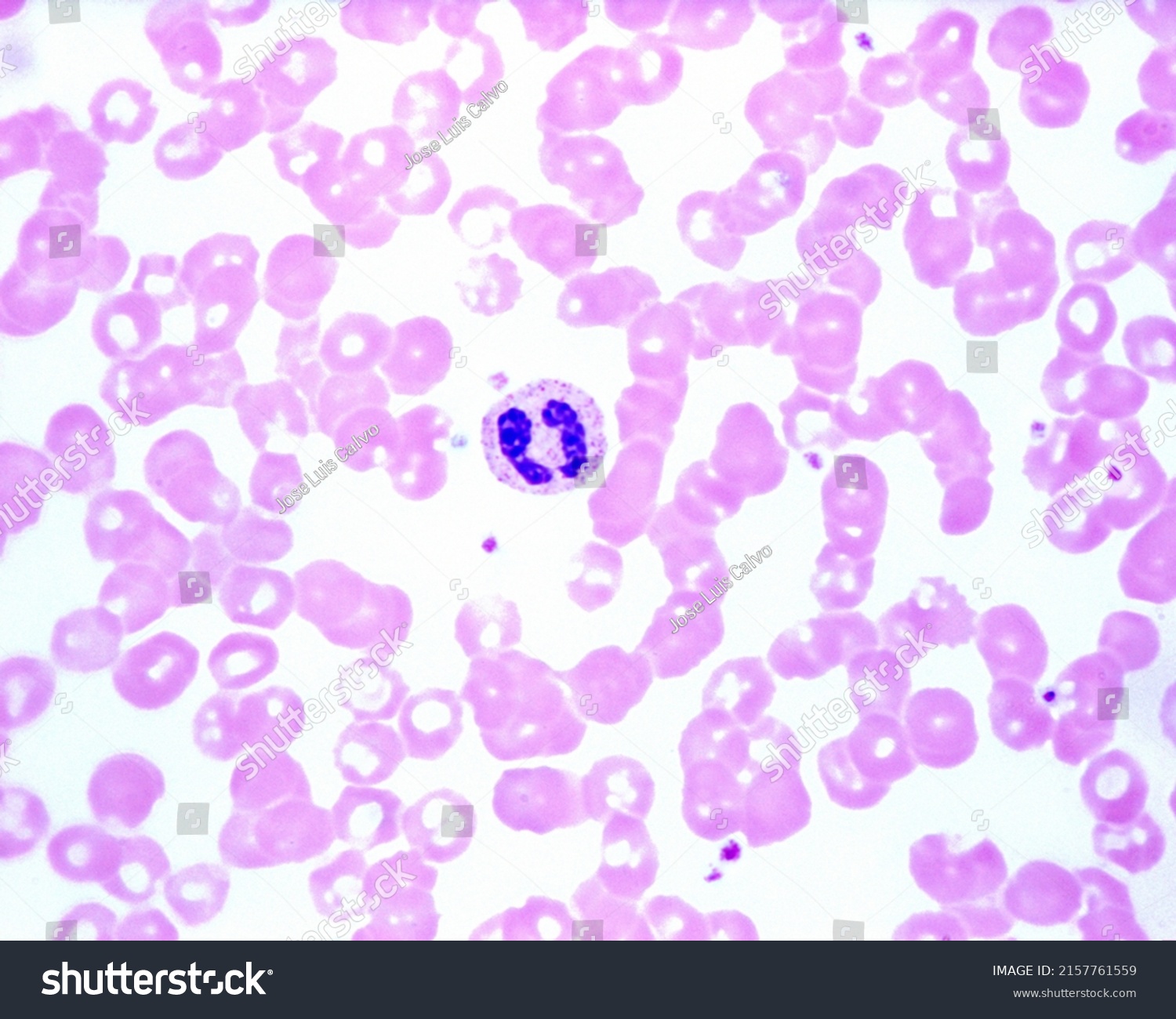 Human Blood Smear Showing Neutrophil Leukocyte Stock Photo 2157761559 ...