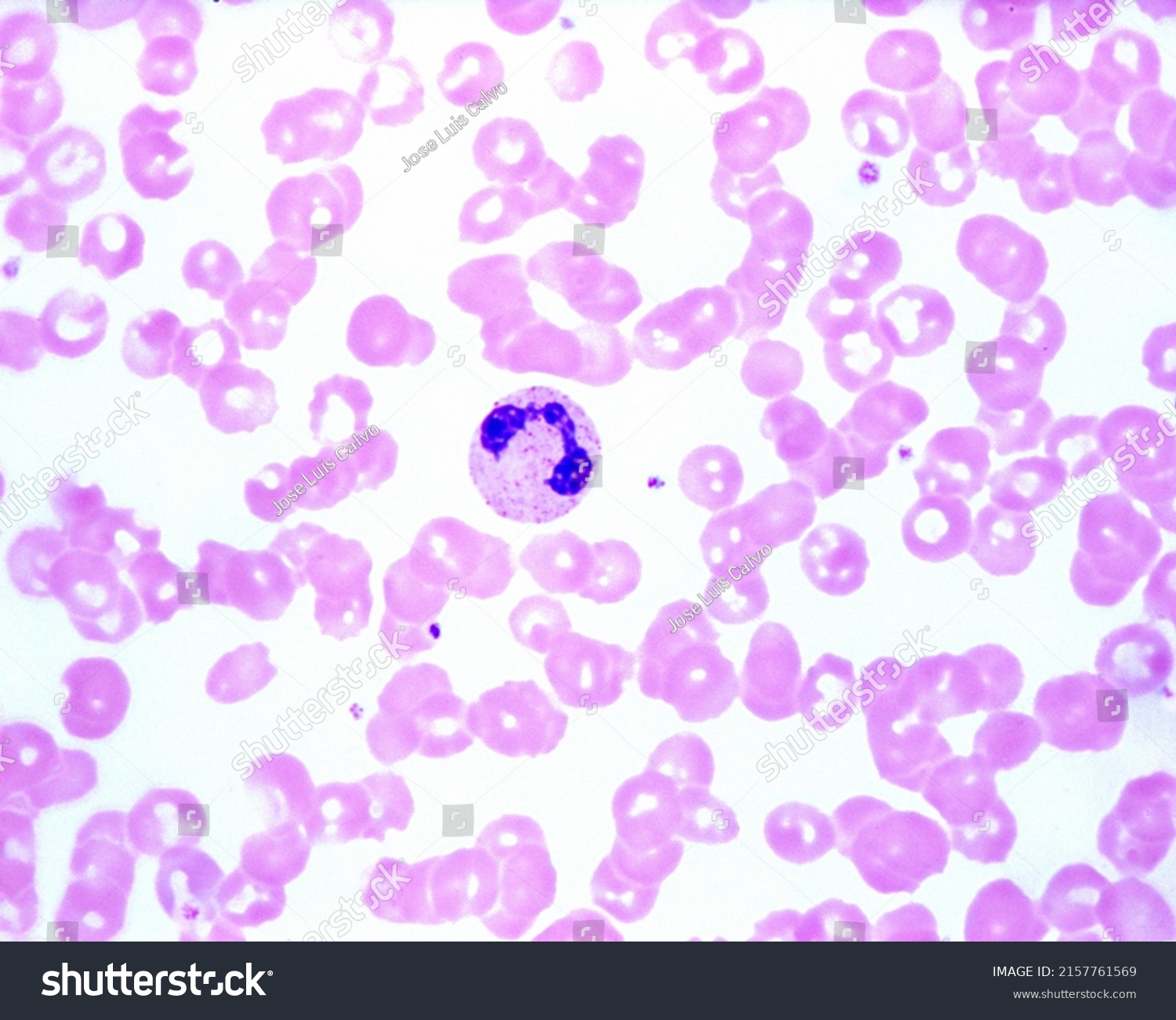 Human Blood Smear Showing Neutrophil Leukocyte Stock Photo 2157761569 ...