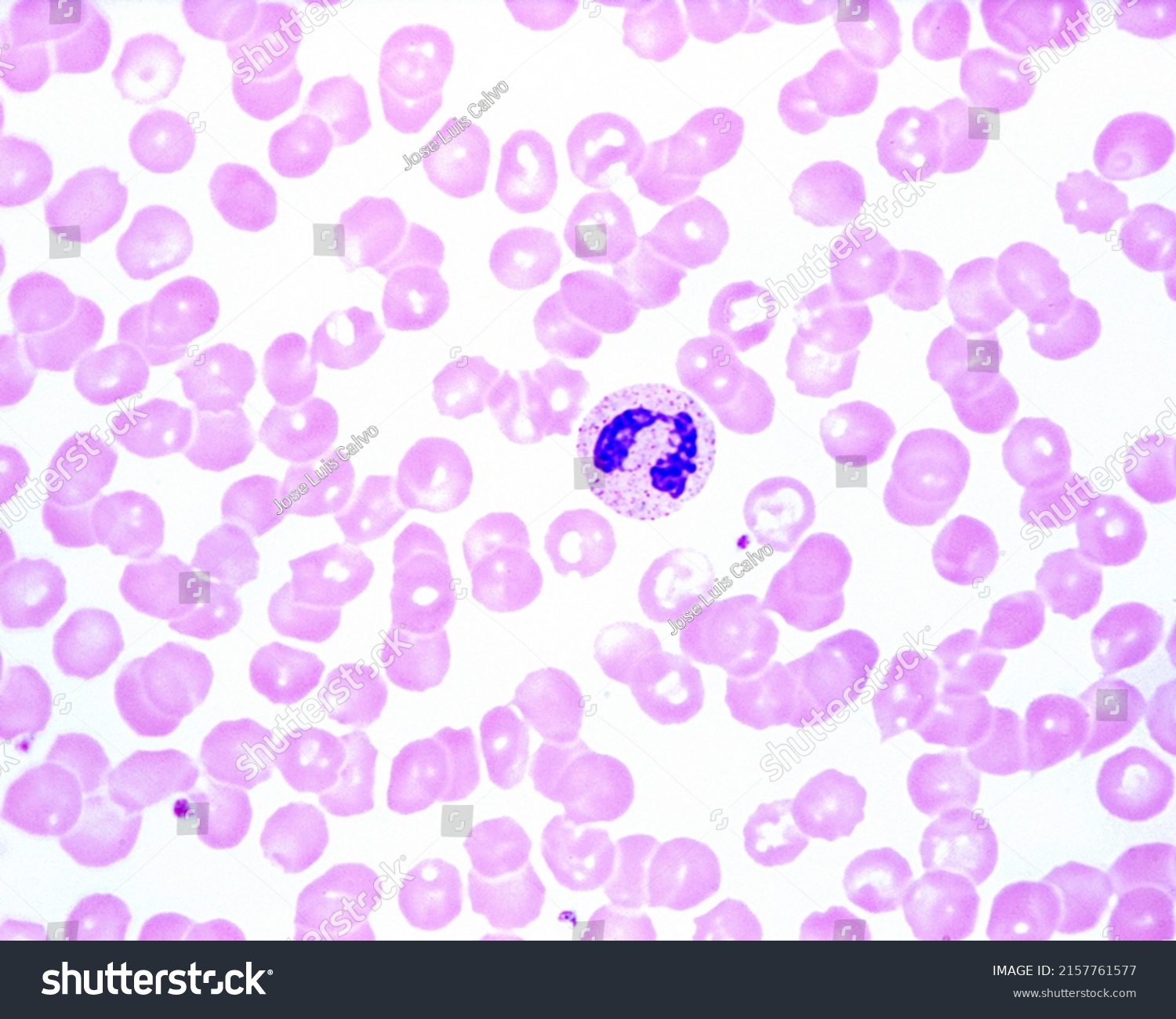 Human Blood Smear Showing Neutrophil Leukocyte Stock Photo 2157761577 ...