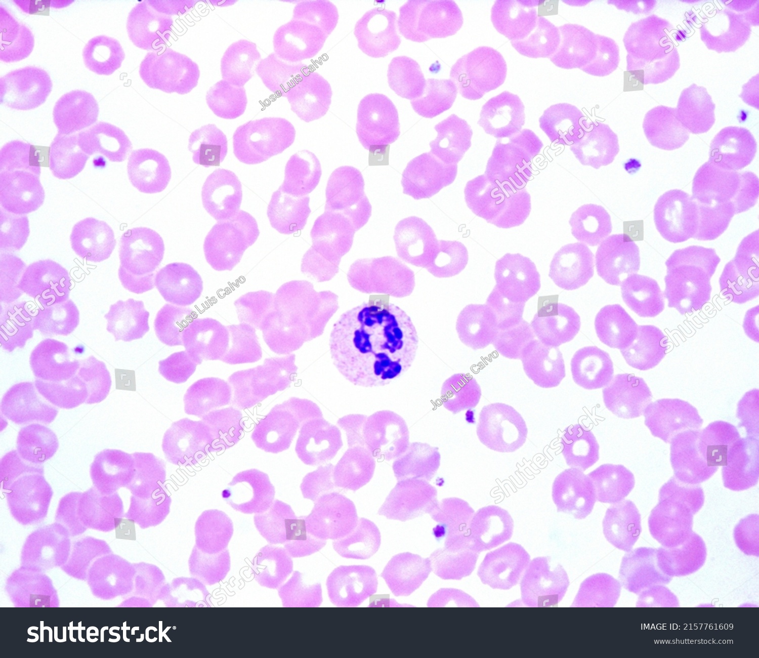 Human Blood Smear Showing Neutrophil Leukocyte Stock Photo 2157761609 ...