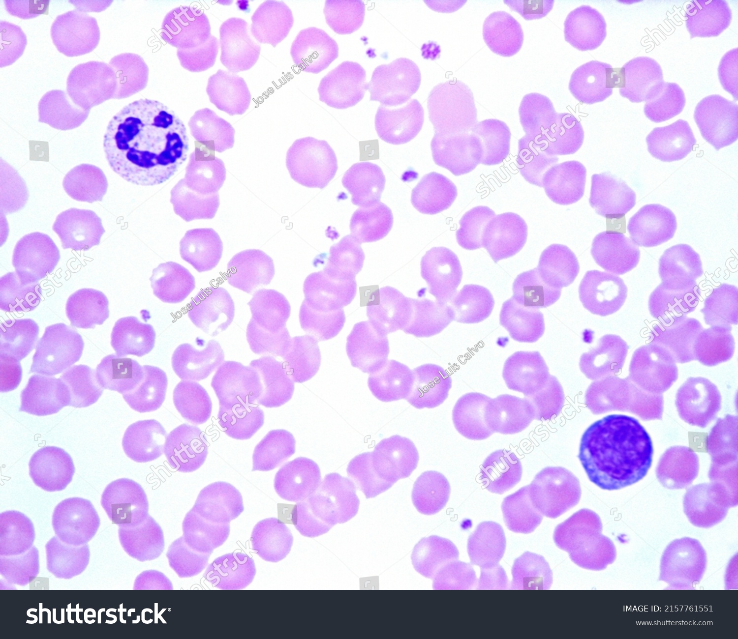 Human Blood Smear Showing Neutrophil Leukocyte Stock Photo 2157761551 ...