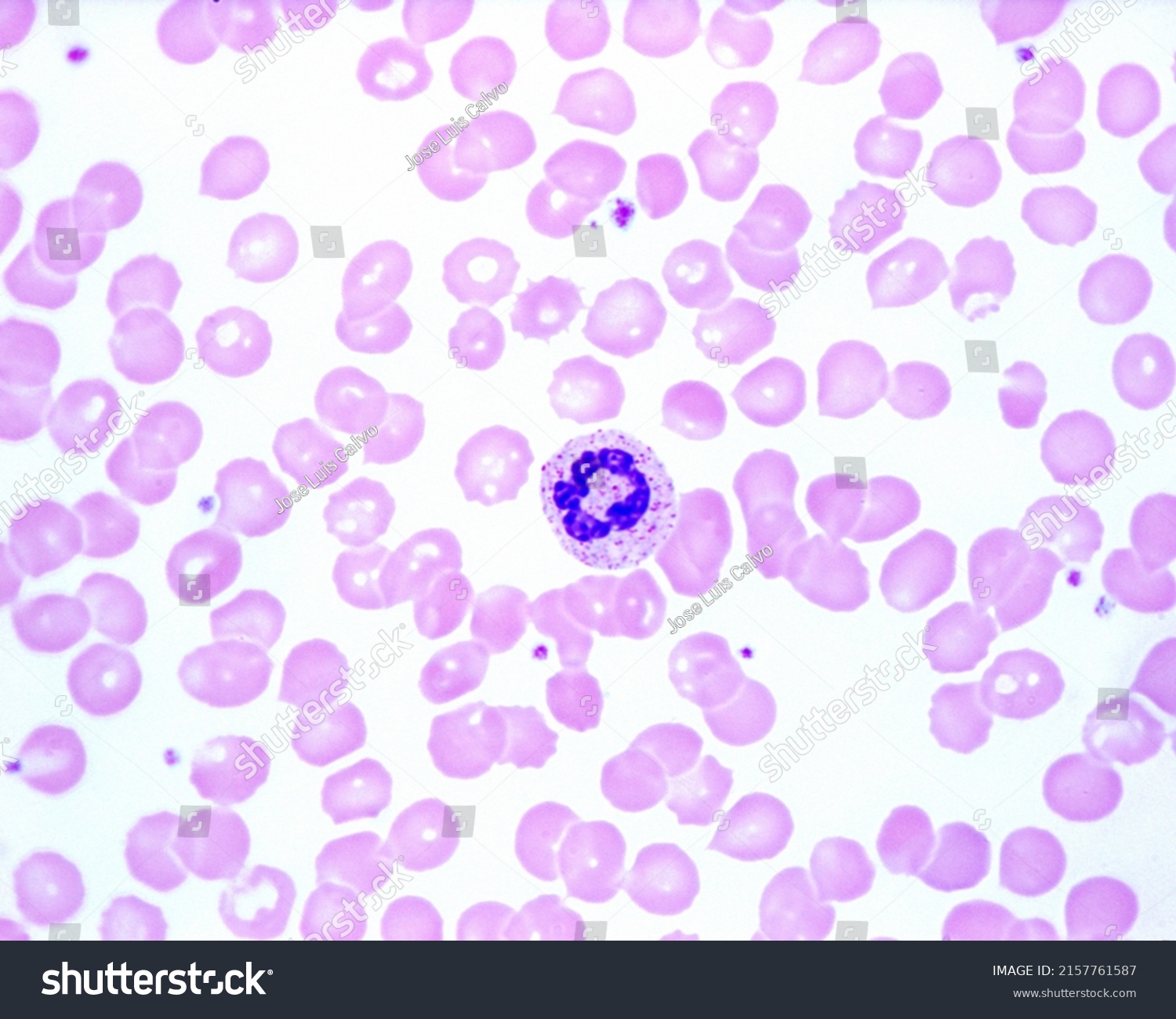 Human Blood Smear Showing Neutrophil Ringshaped Stock Photo 2157761587 ...