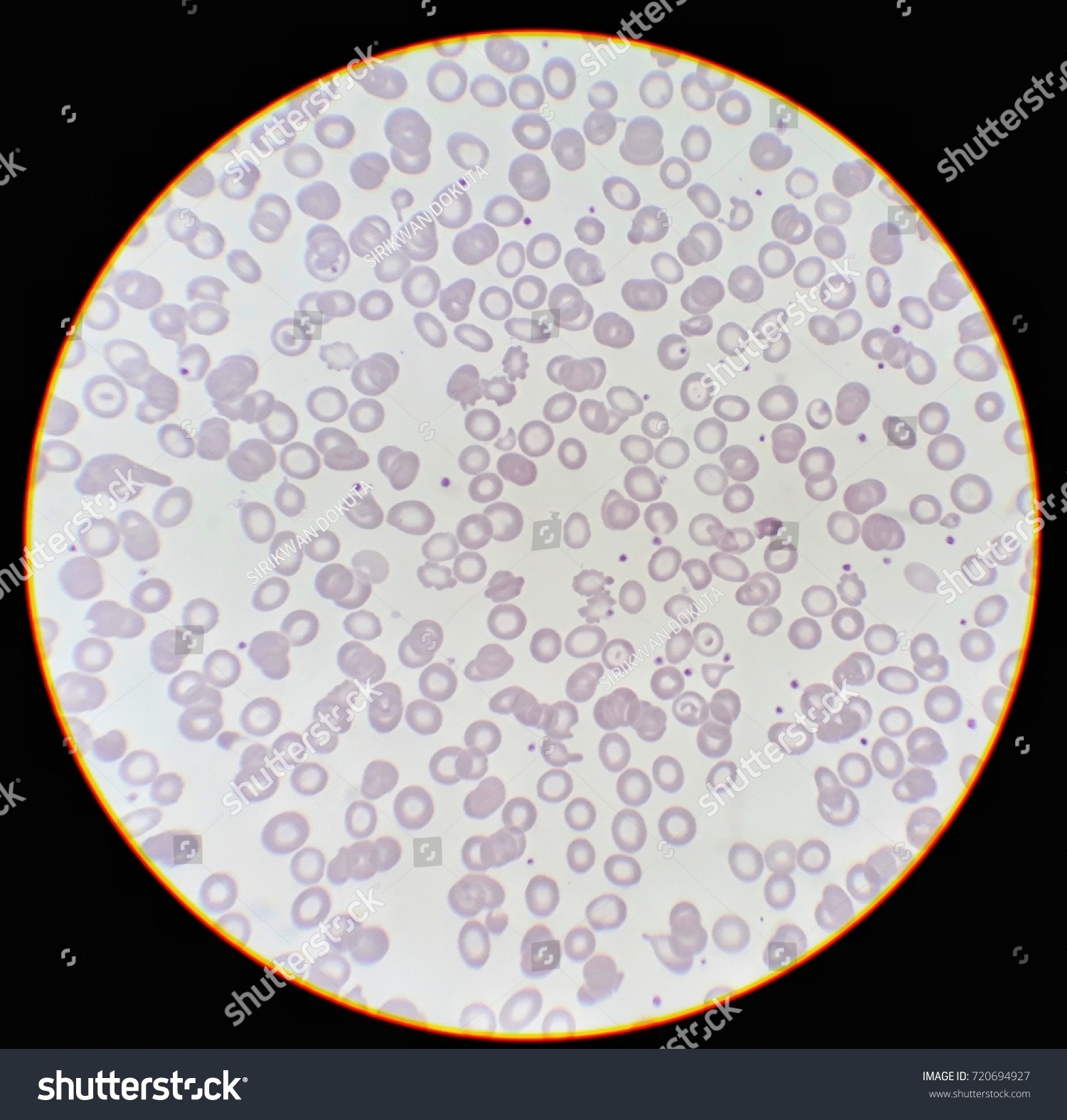 Human Blood Smear Under 100x Light Stock Photo (Edit Now) 720694927