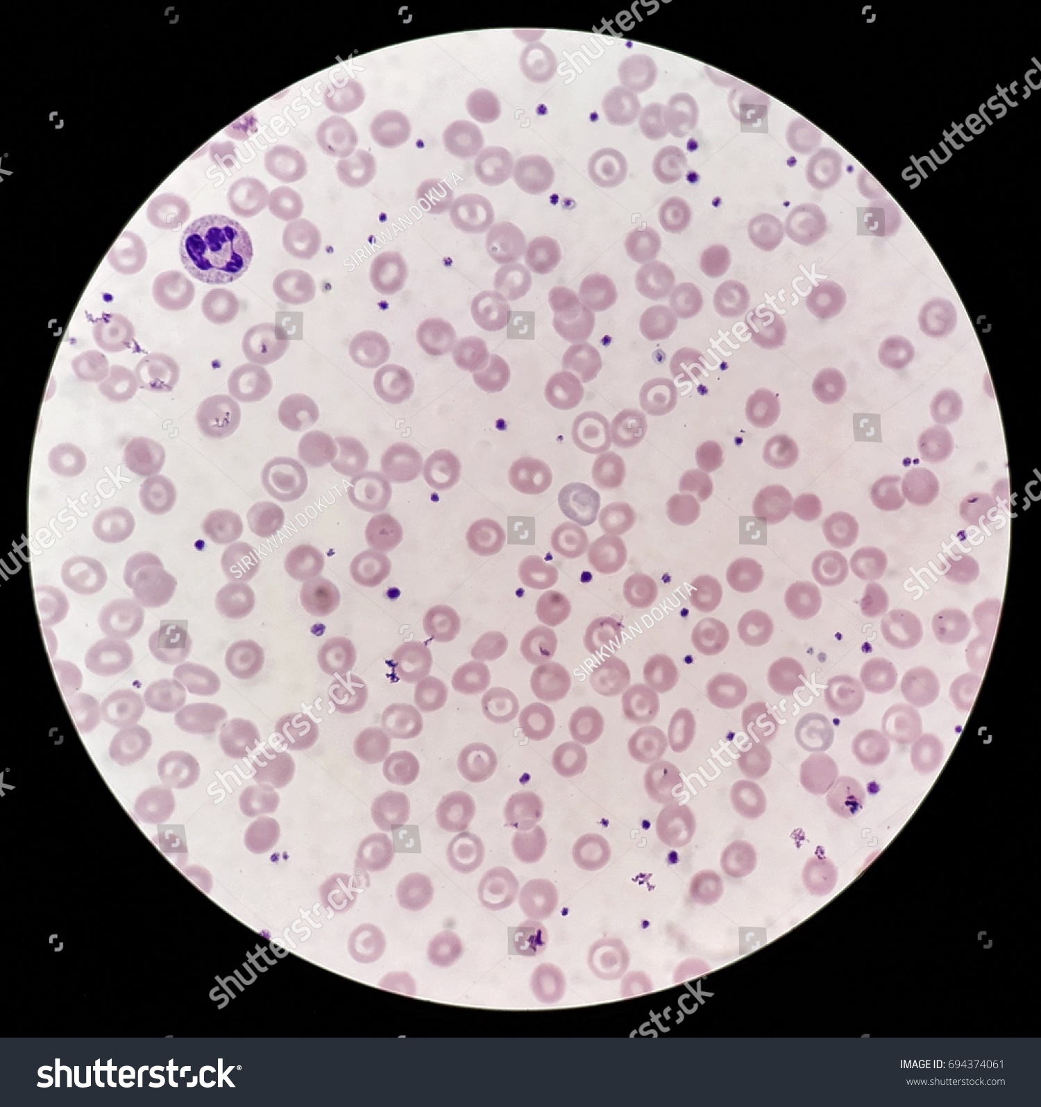 Human Blood Smear Under 100x Light Stock Photo 694374061 - Shutterstock