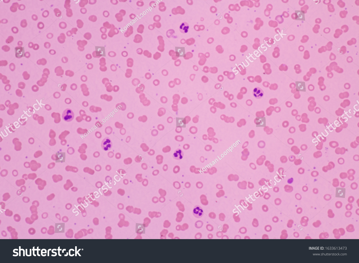 Human Blood Smear View Microscopycomplete Blood Stock Photo Edit Now