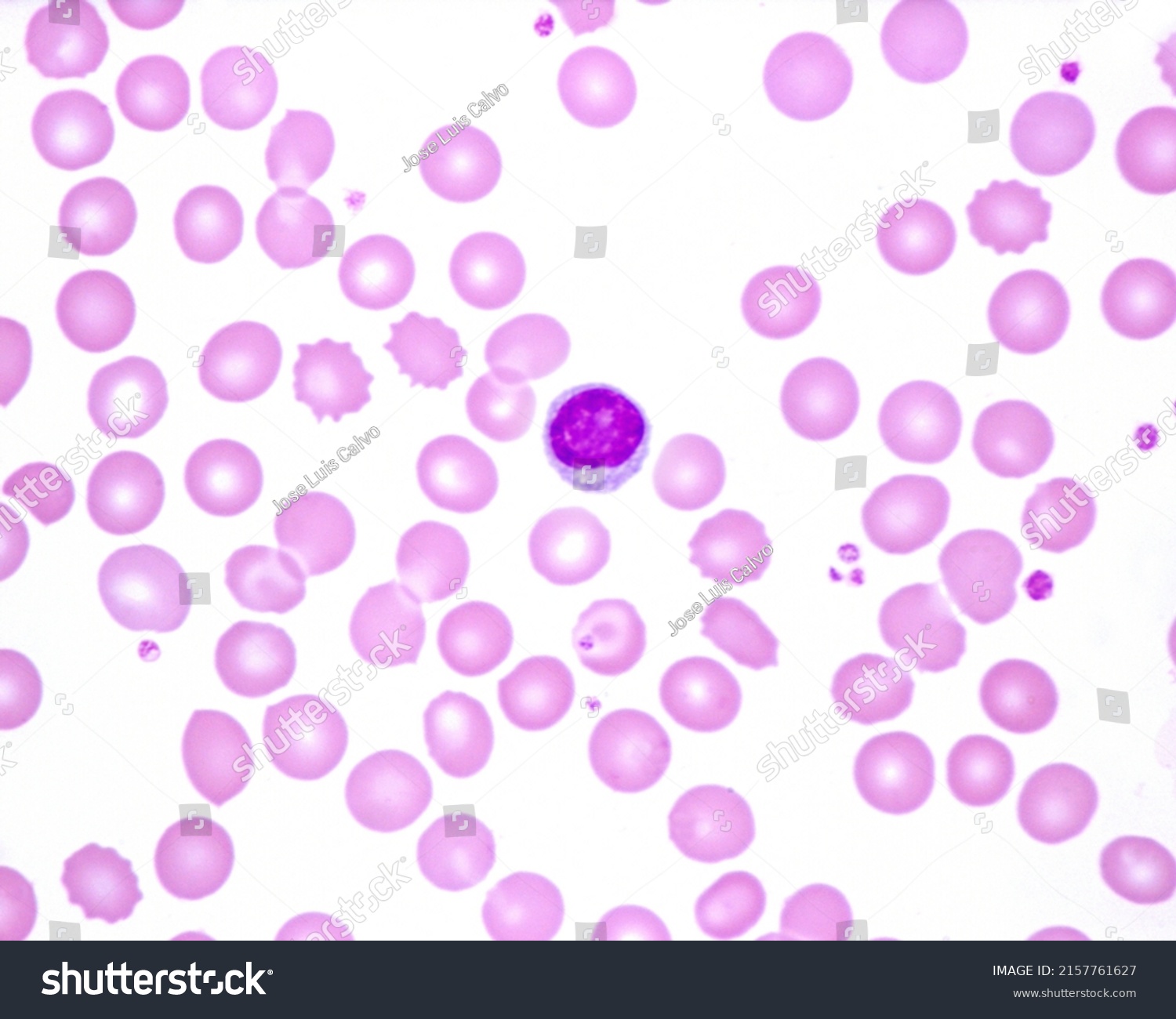 Human Blood Smear Where Lymphocyte Observed Stock Photo 2157761627 ...