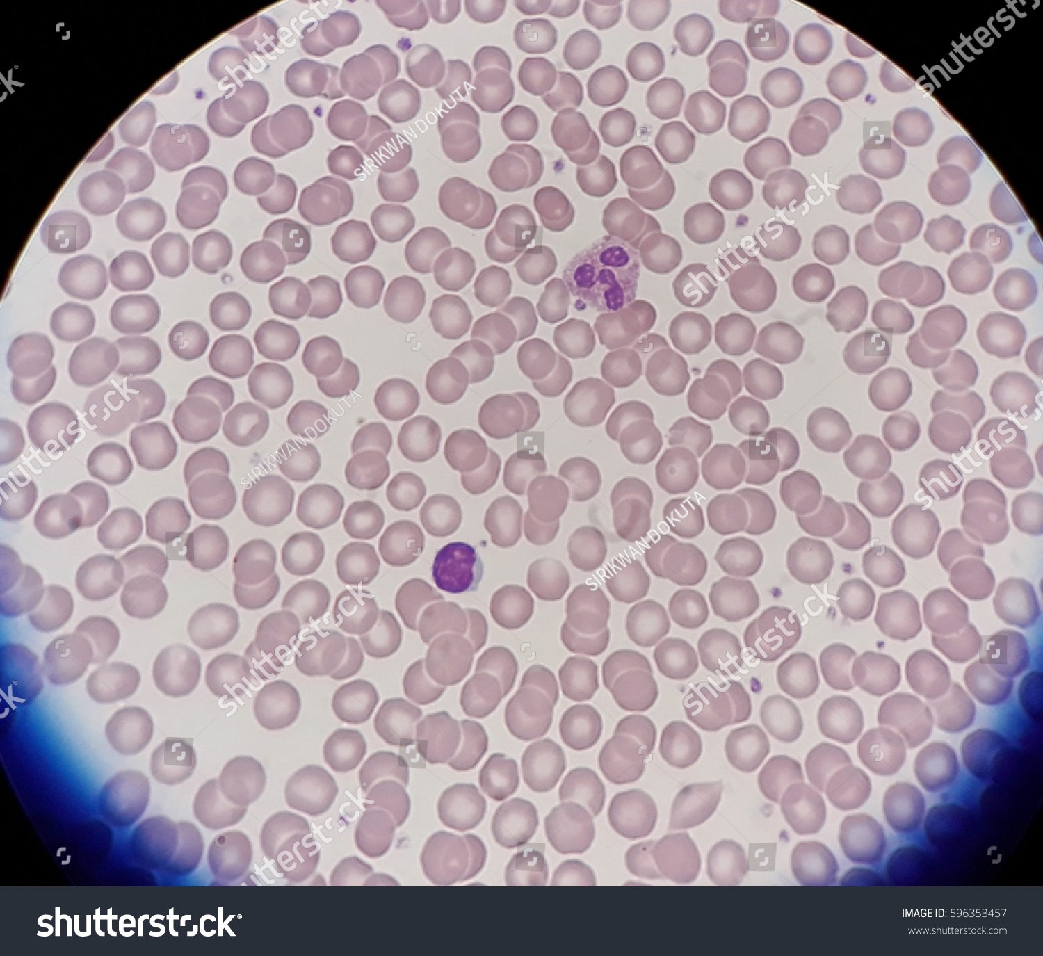 Human Blood Smear Normal Red BloodẢnh có sẵn596353457 | Shutterstock