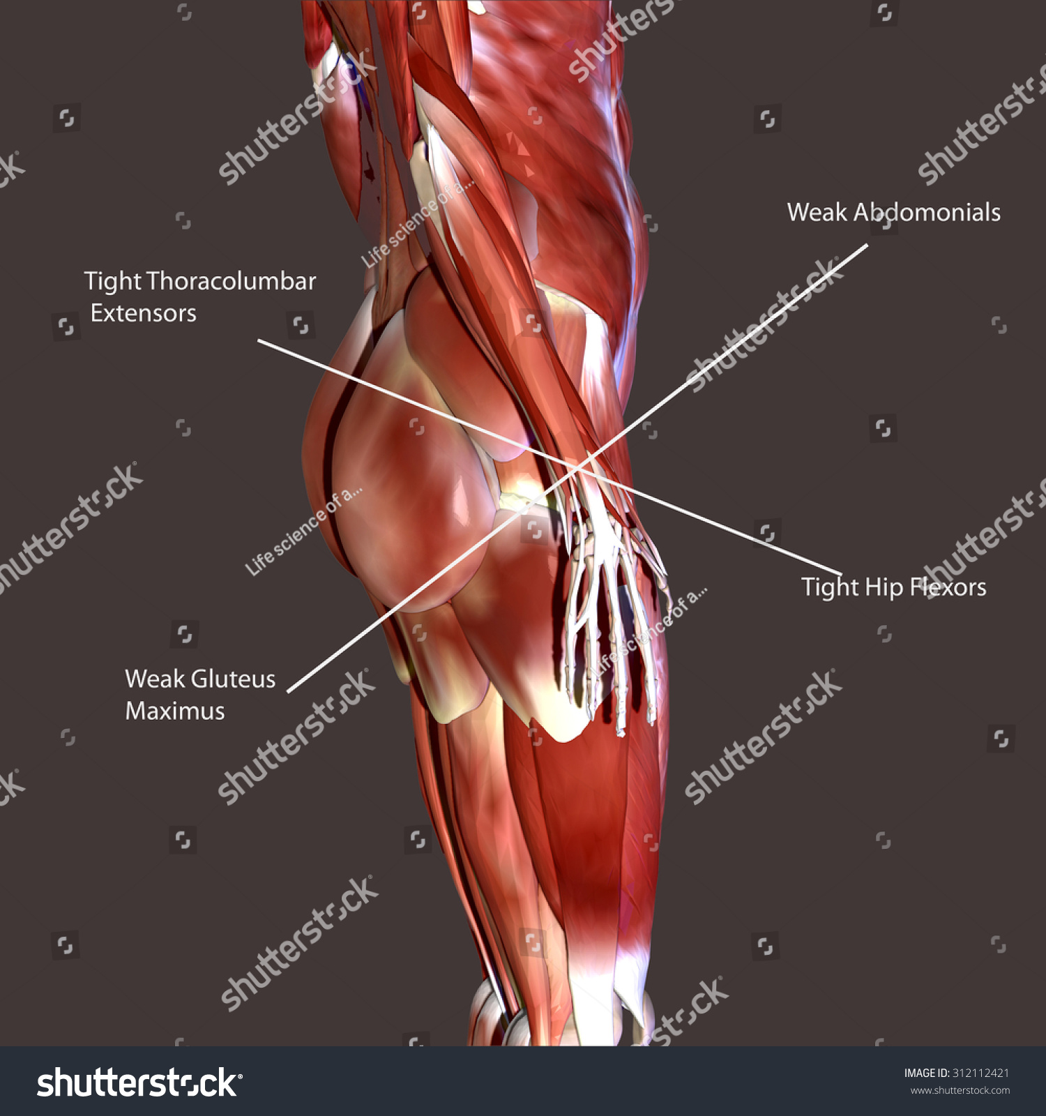 Human Body Muscles Stock Photo 312112421 : Shutterstock