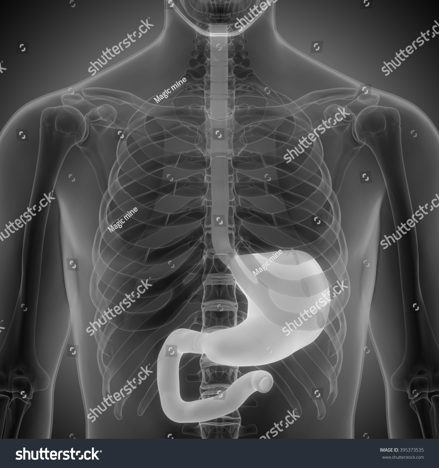 Human Body Organs Stomach Anatomy Stock Illustration 395373535