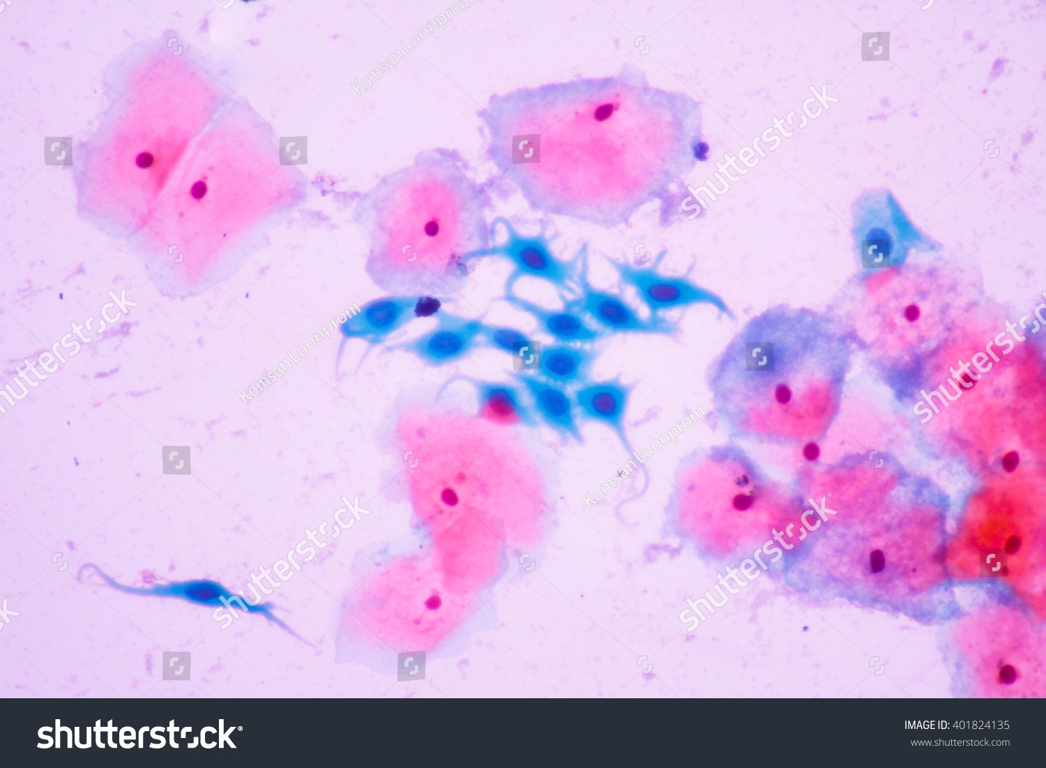 Human Cells View In Microscopy.Squamous Metaplastic Cells From Pap ...