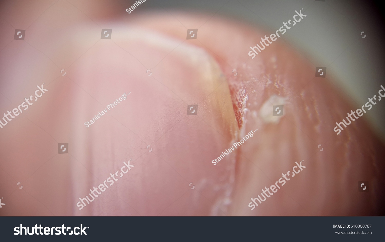 Human Fingernail Under Microscope Stock Photo Edit Now