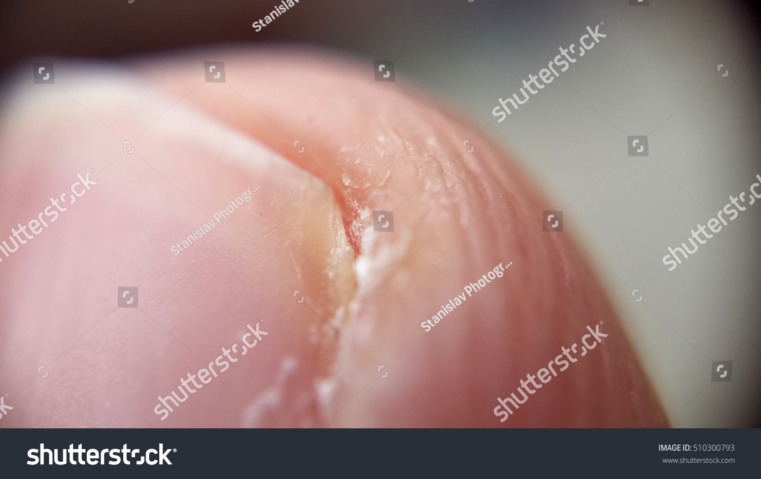 Human Fingernail Under Microscope Stock Photo Edit Now