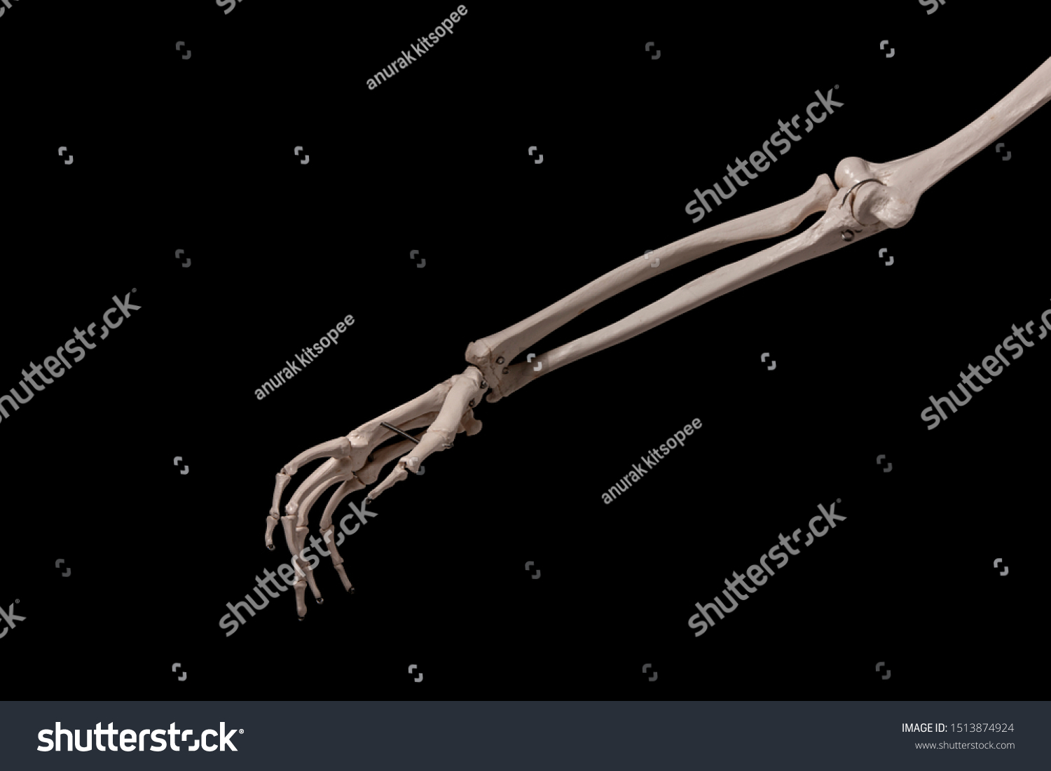 Human Forearm Skeleton Stock Photo (Edit Now) 1513874924