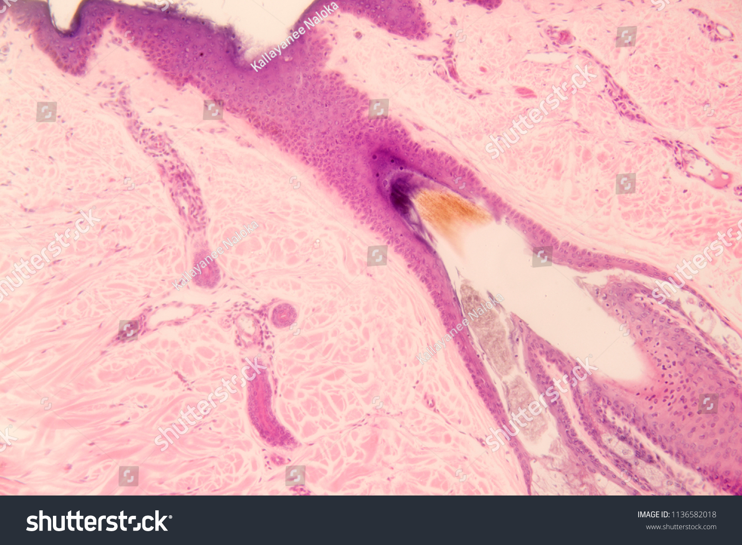 Human Hair Follicle Section Under Microscope Stock Photo (Edit Now ...