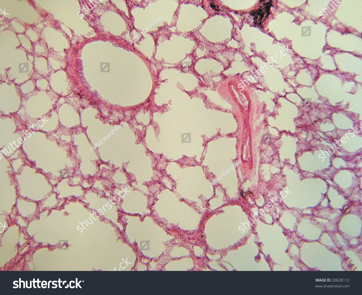 Human Lung Tissue 100x Blood Vessels Stock Photo 20628112 - Shutterstock