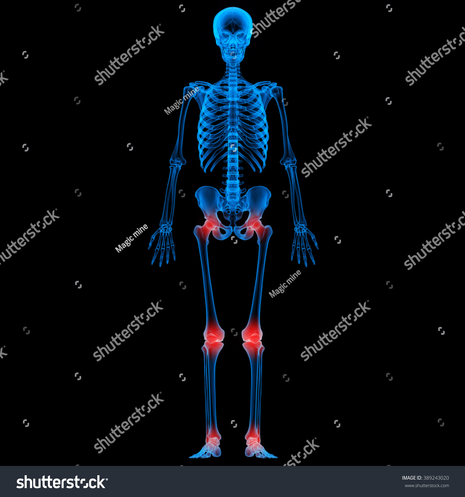 Human Skeleton Bone Joint Pains Stock Photo 389243020 : Shutterstock