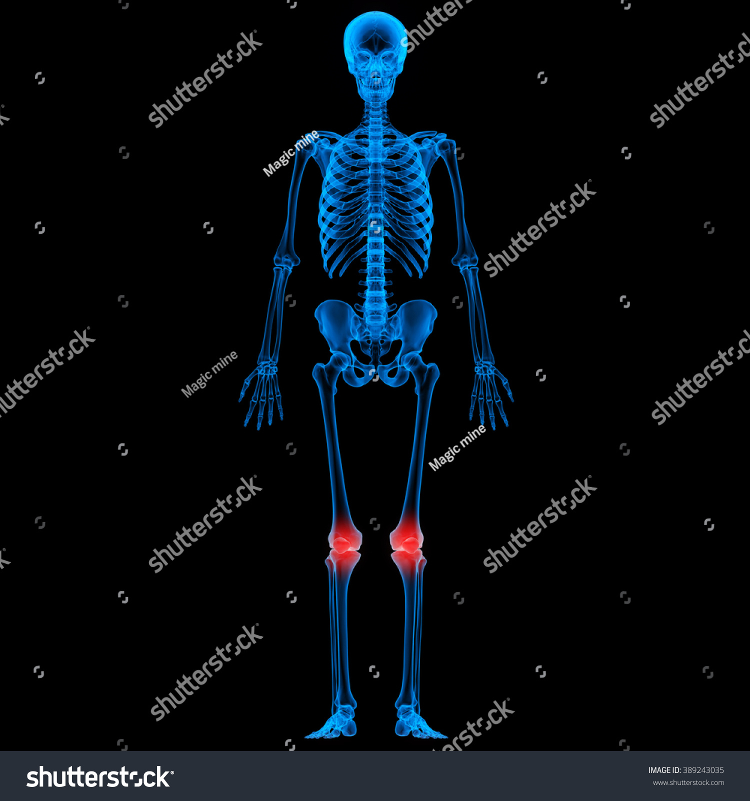 Human Skeleton Bone Joint Pains Stock Photo 389243035 : Shutterstock
