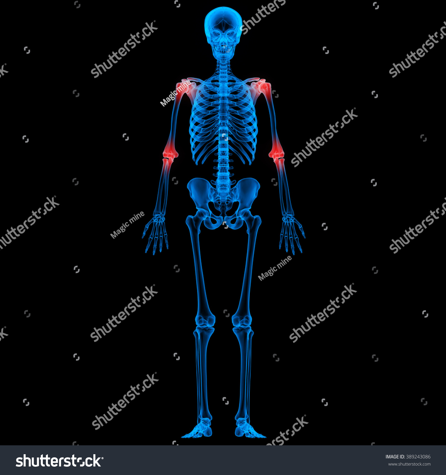 Human Skeleton Bone Joint Pains Stock Photo 389243086 : Shutterstock