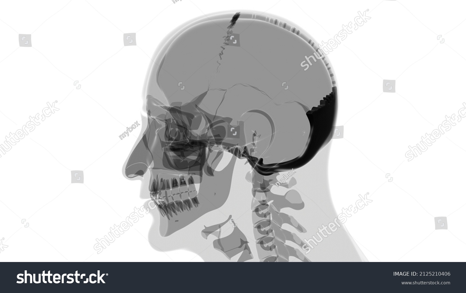 Human Skeleton Skull Occipital Bone Anatomy Stock Illustration 2125210406 Shutterstock 7031