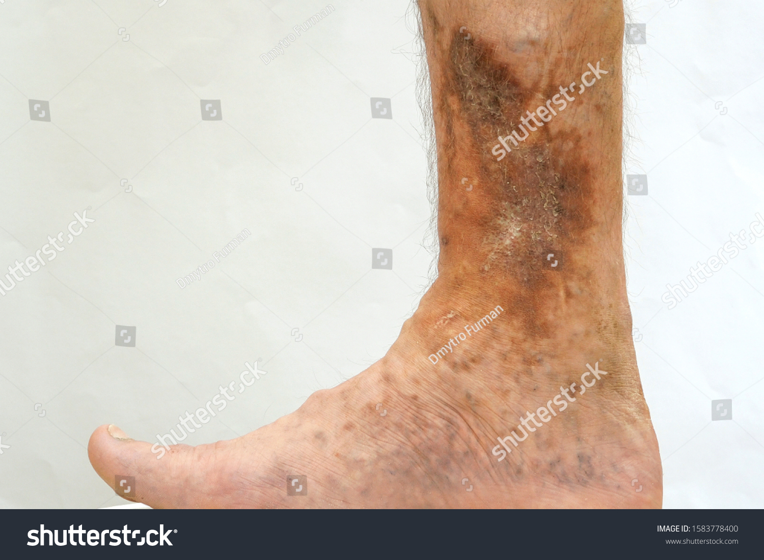 19-gaiter-area-images-stock-photos-vectors-shutterstock