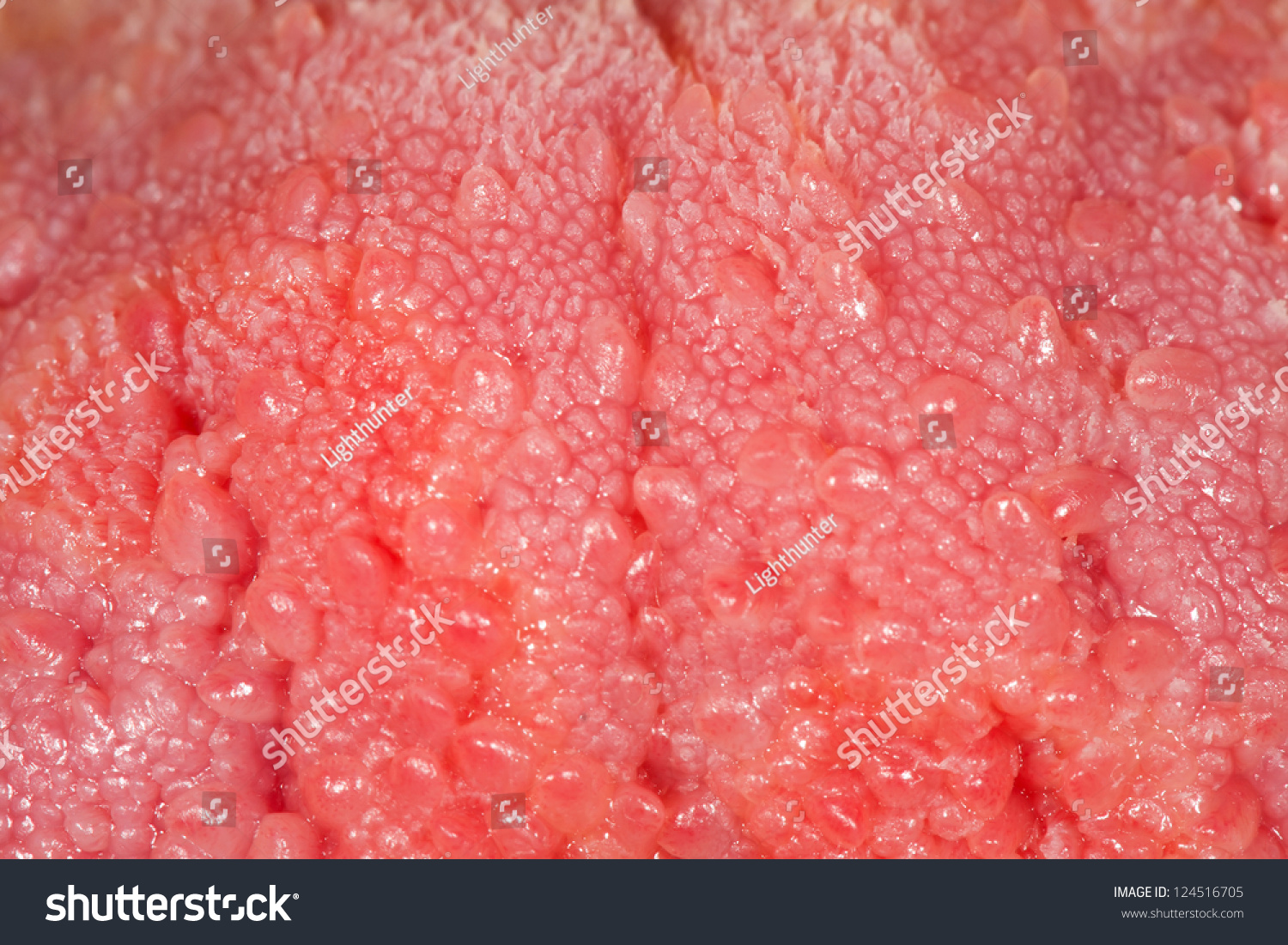 Close Up Pictures Of Human Tongue Papillae 47