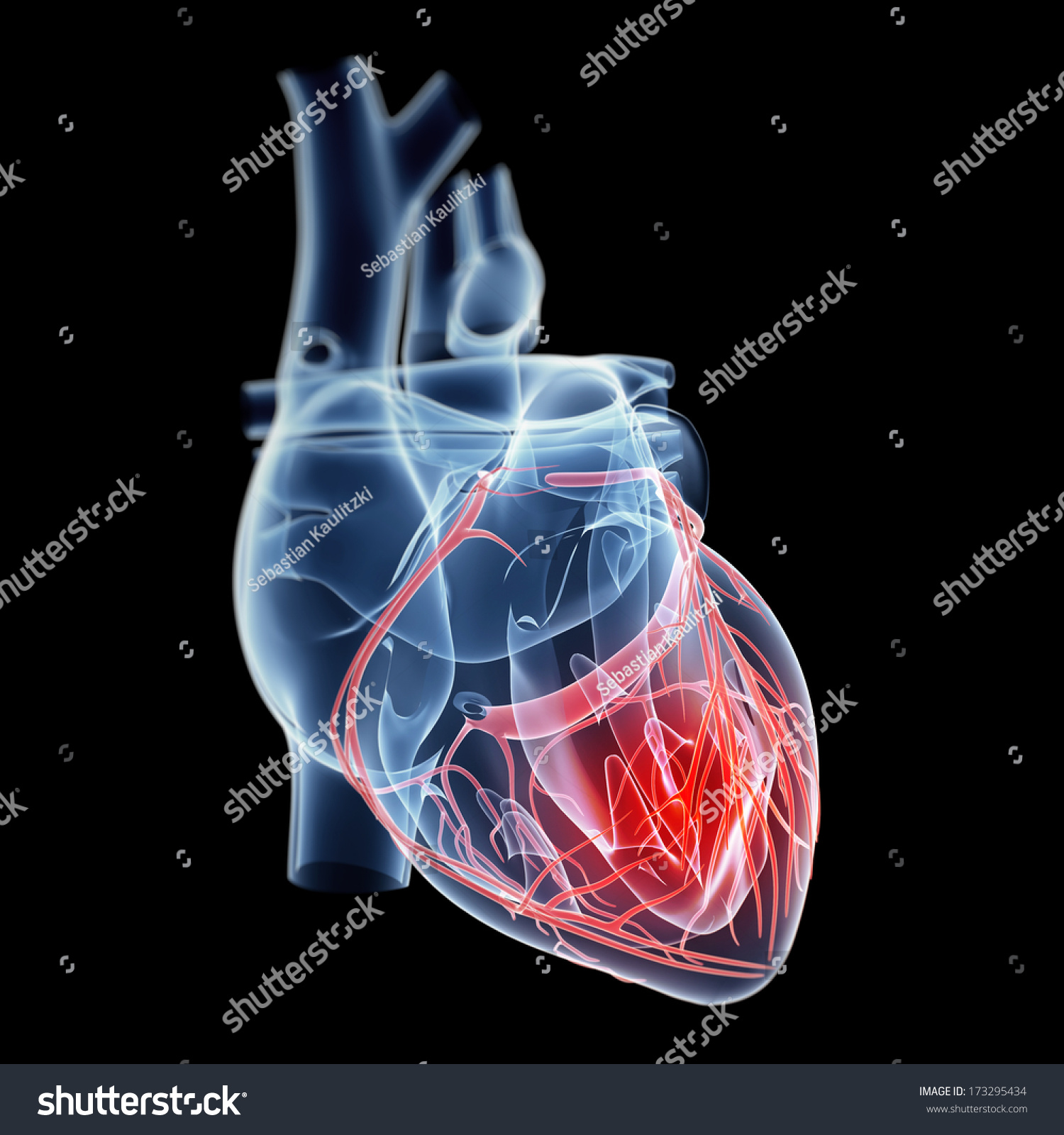 Illustration Showing Pain In The Heart - 173295434 : Shutterstock