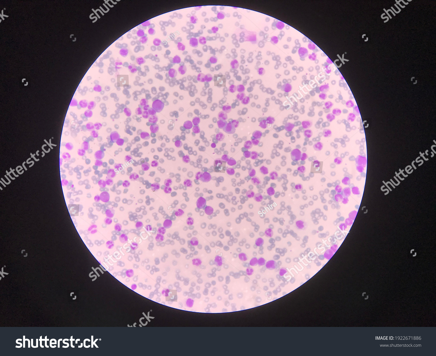 immature-mature-white-blood-cellssegmented-neutrophilblast