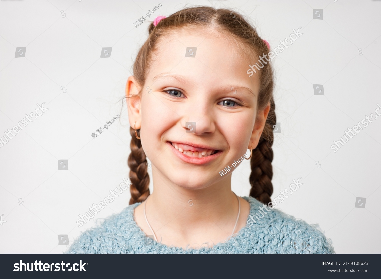 childs-mouth-two-upper-front-milk-stock-photo-2149108623-shutterstock