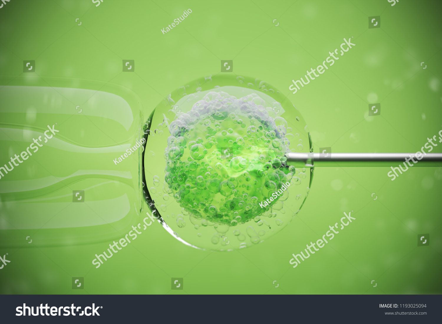 Vitro Fertilization Human Female Cell On Stock Illustration 1193025094 Shutterstock 7540