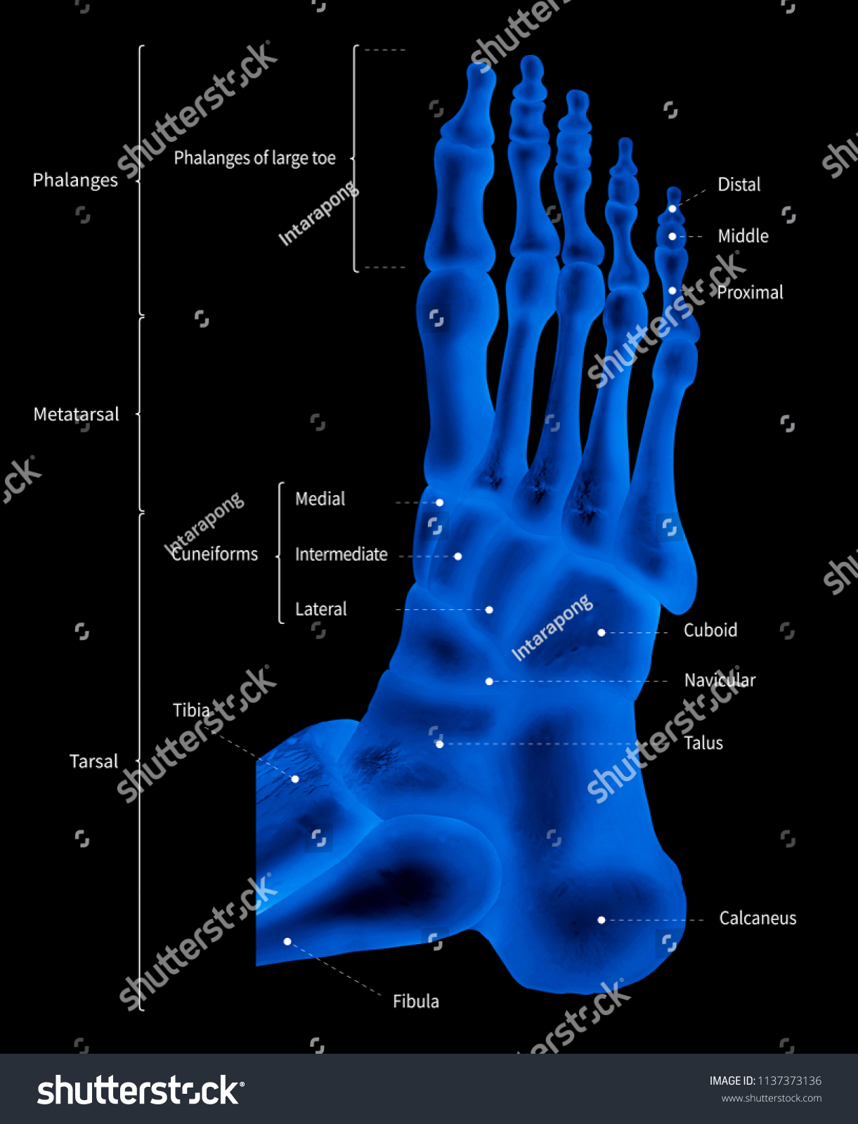 Infographic Diagram Human Foot Bone Anatomy Stock Illustration 1137373136