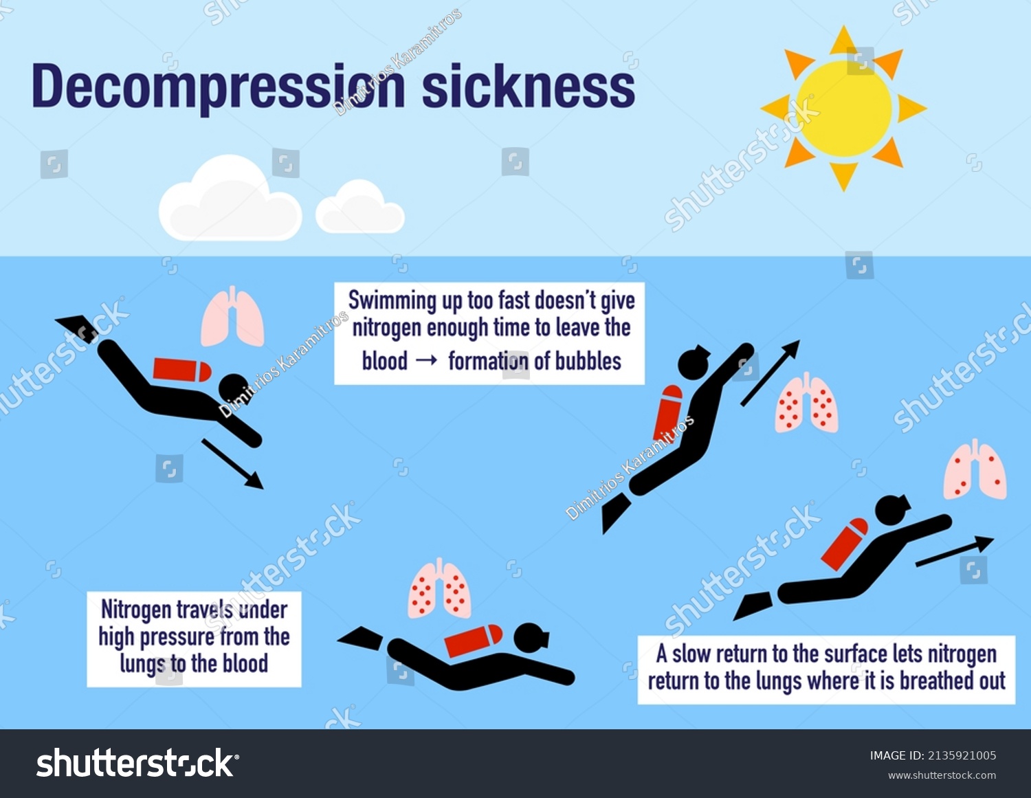 Stock Photo Infographic Explaining The Decompression Sickness Or Divers Disease 2135921005 