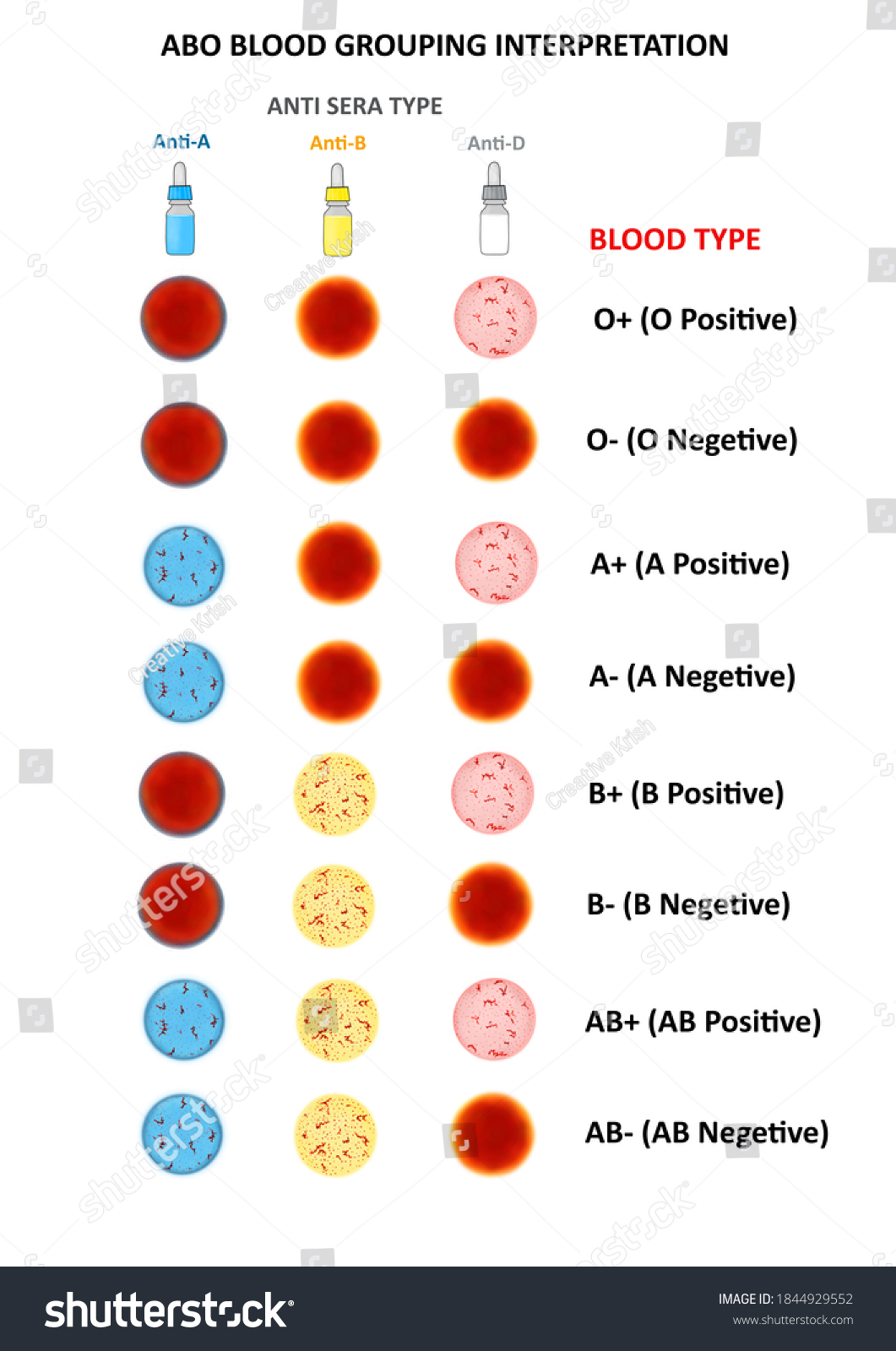 Interpretation Abo Blood Grouping Laboratory Technique Stock