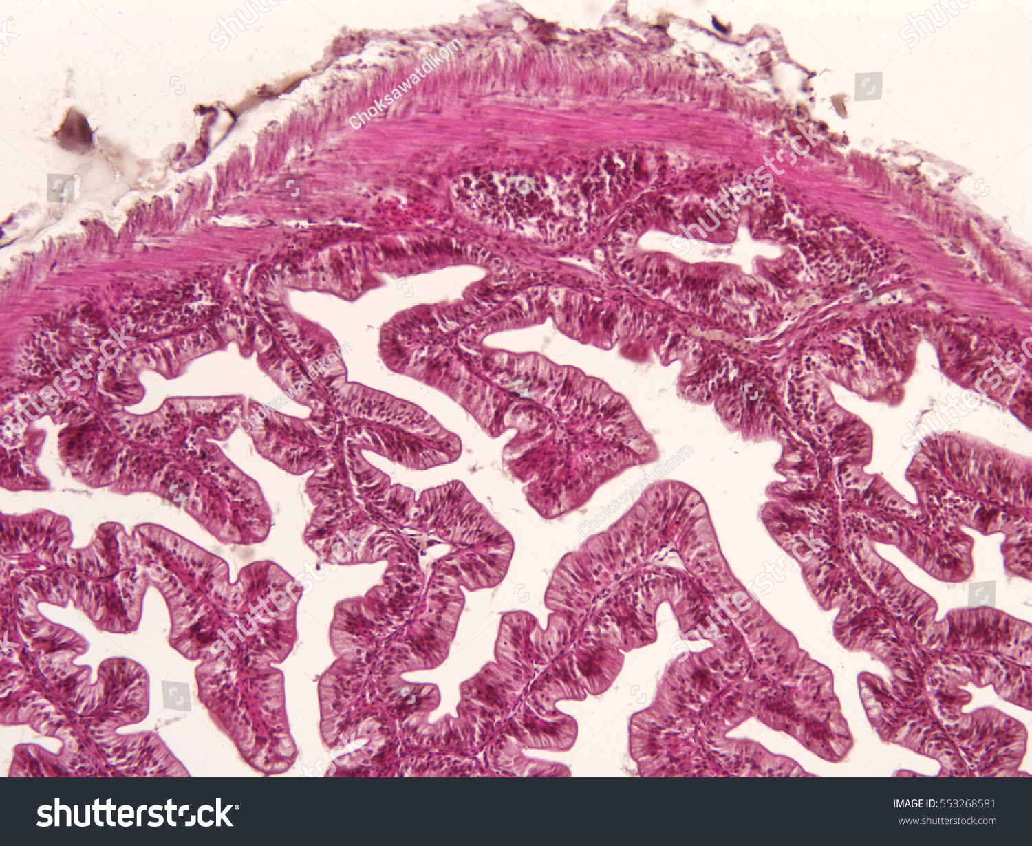 Intestine Animal Tissue Under Microscope View Stock Photo 553268581 ...