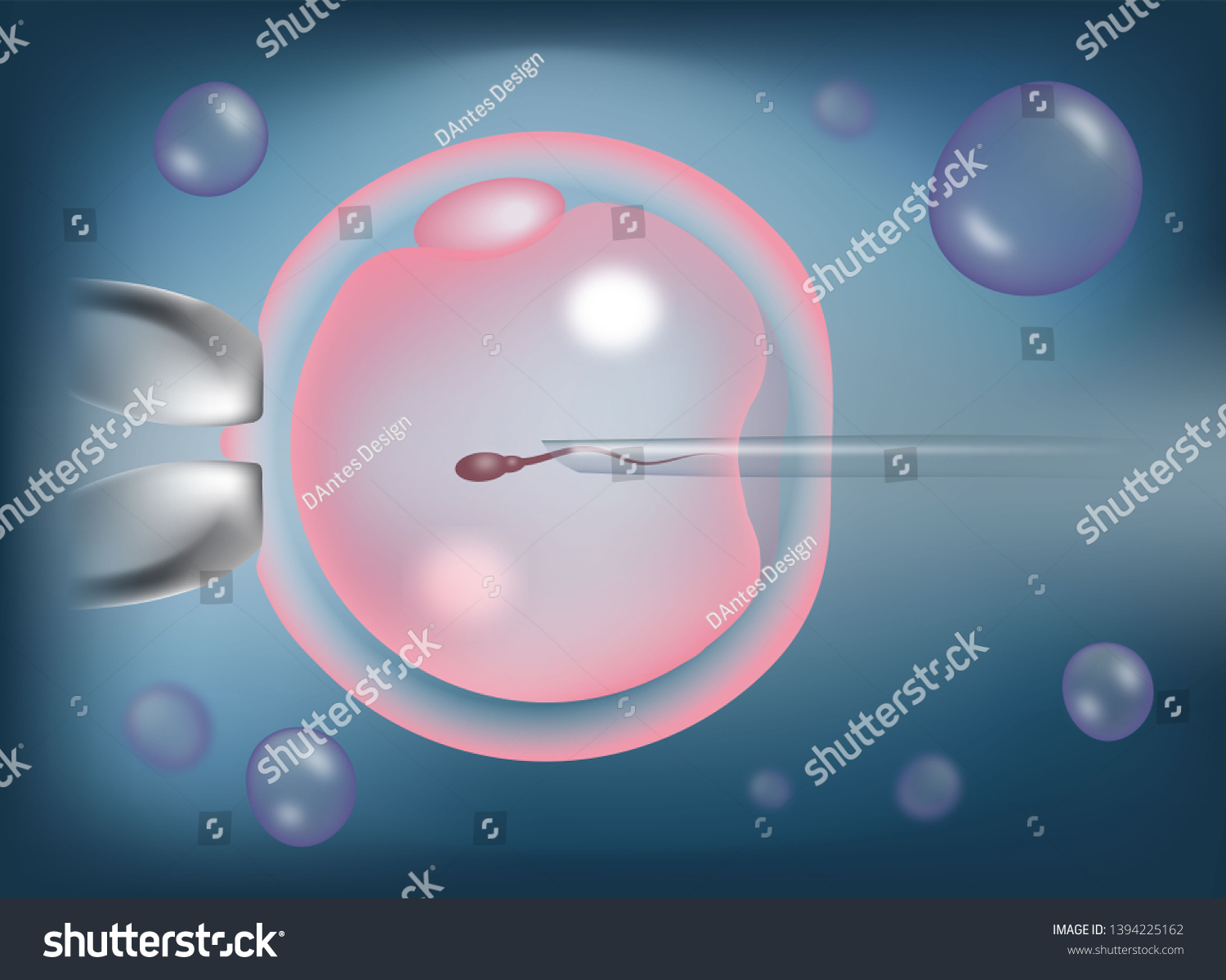 Intracytoplasmic Sperm Injection Images Stock Photos Vectors Shutterstock