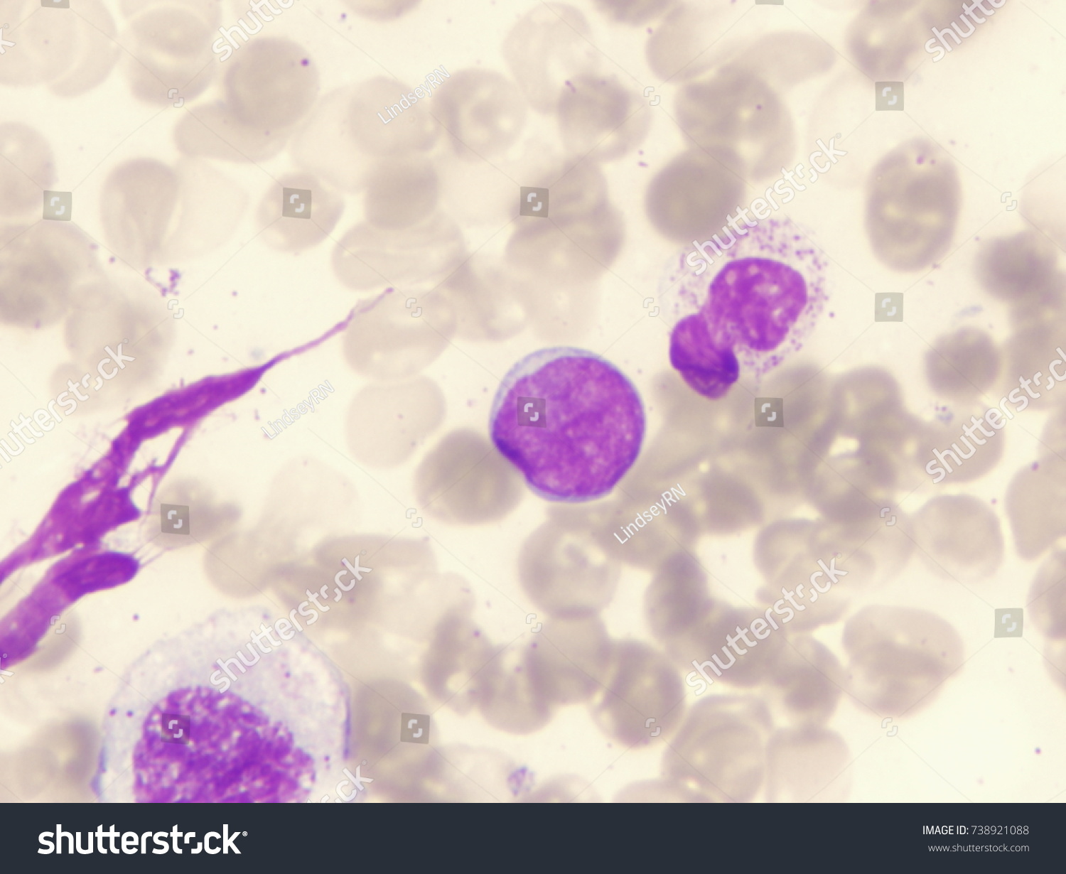 B-cell Images, Stock Photos & Vectors | Shutterstock