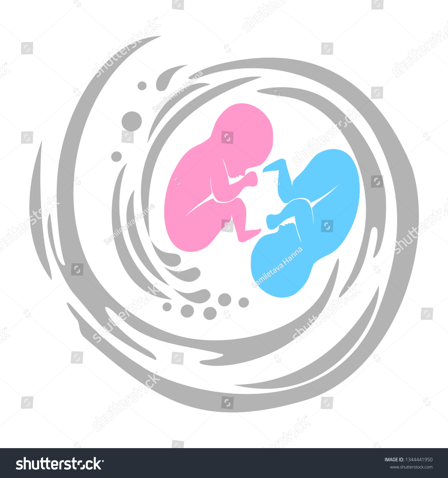 Twins Multiple Pregnancy Monozygotic Twins Embryos Stock Illustration