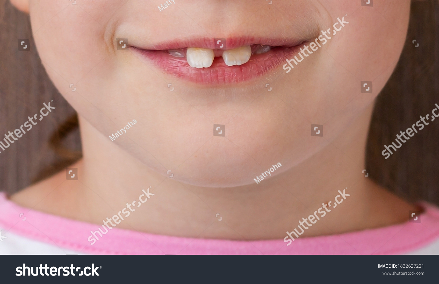 lower-lip-images-stock-photos-vectors-shutterstock