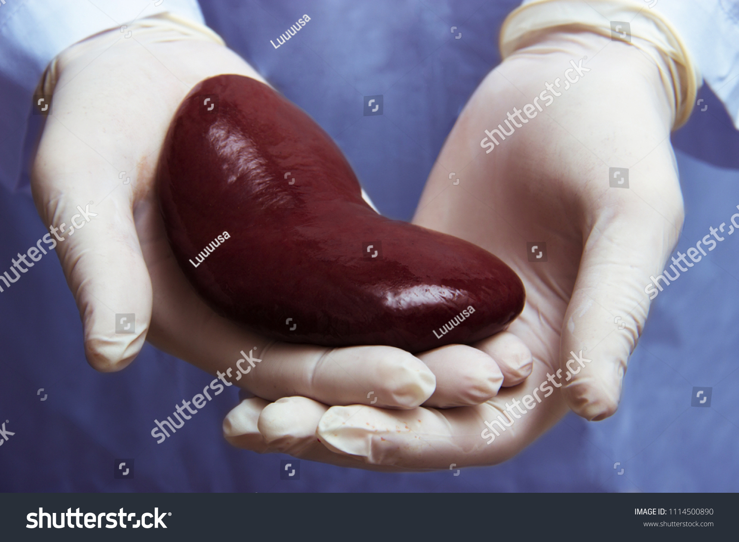 kidney-transplant-surgery-images-stock-photos-vectors-shutterstock