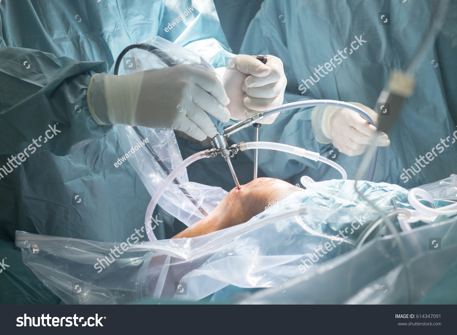 40,415 Orthopedic surgery Images, Stock Photos & Vectors | Shutterstock