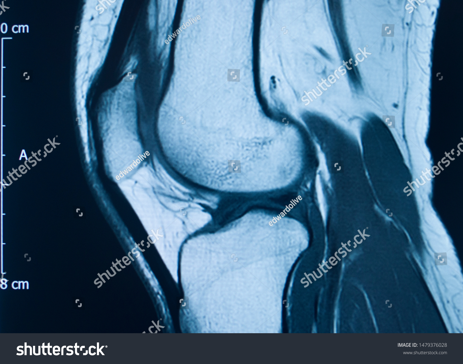 843 Ct scan legs Stock Photos, Images & Photography | Shutterstock