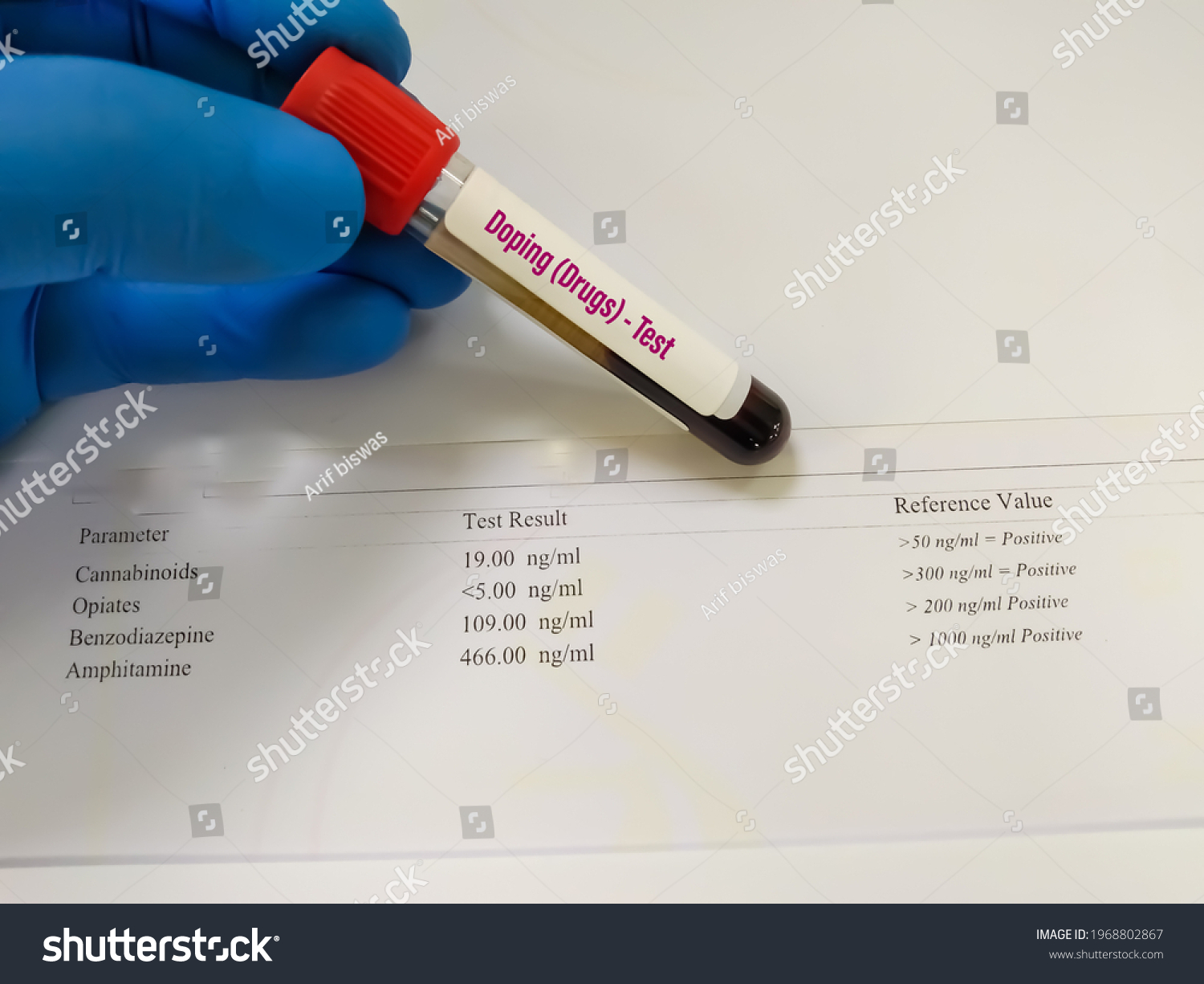 Laboratory Sample Blood Doping Drugs Test Stock Photo 1968802867 ...